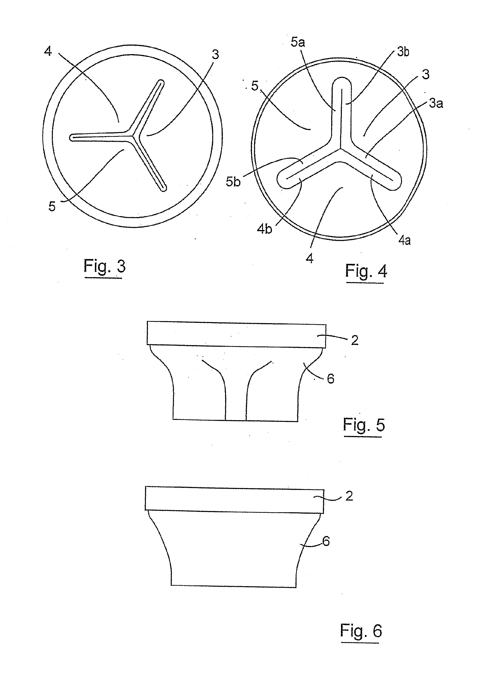 Luminal prosthesis and a gastrointestinal implant device