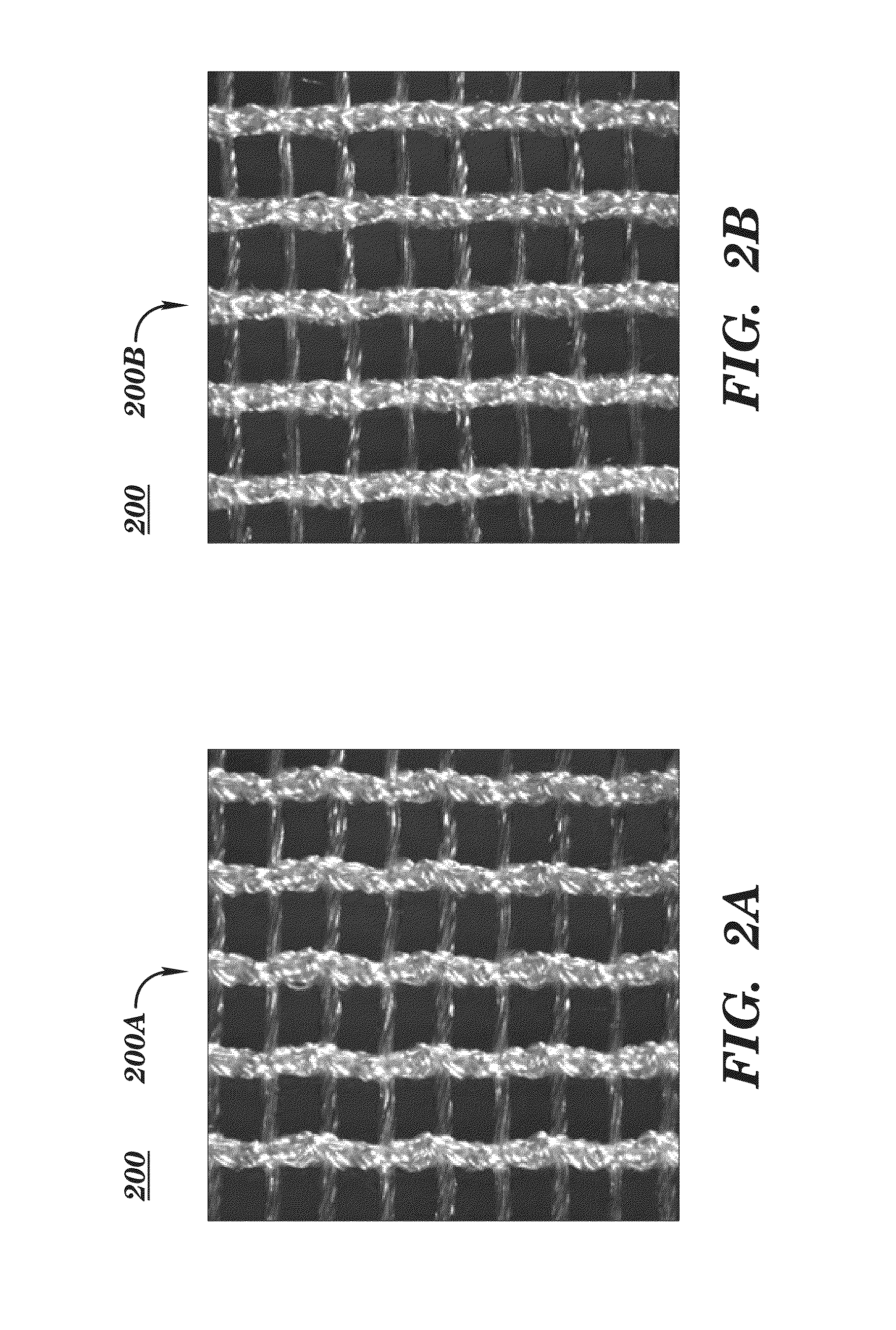 Silk medical device for use in breast augmentation and breast reconstruction