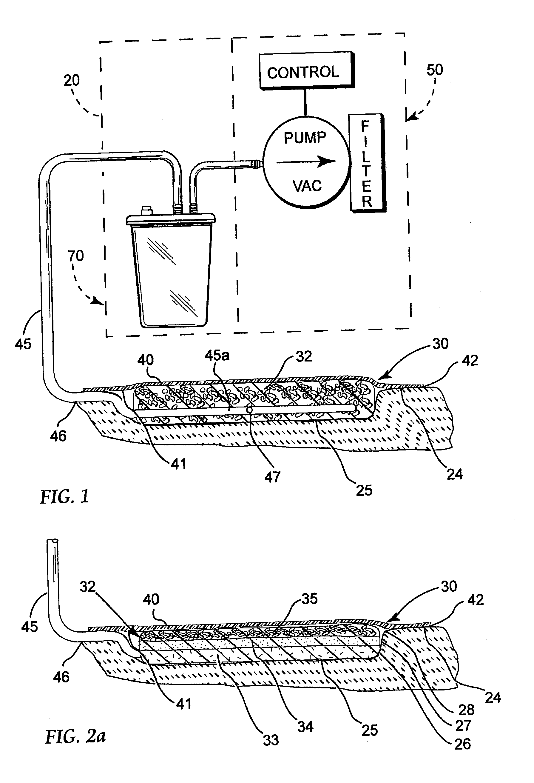 Reduced pressure treatment system