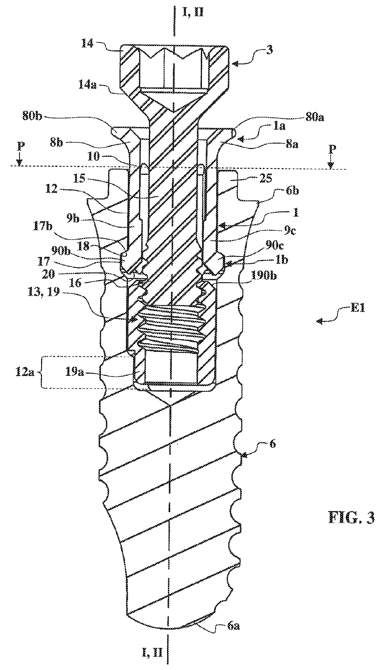 Intermediate attachment part