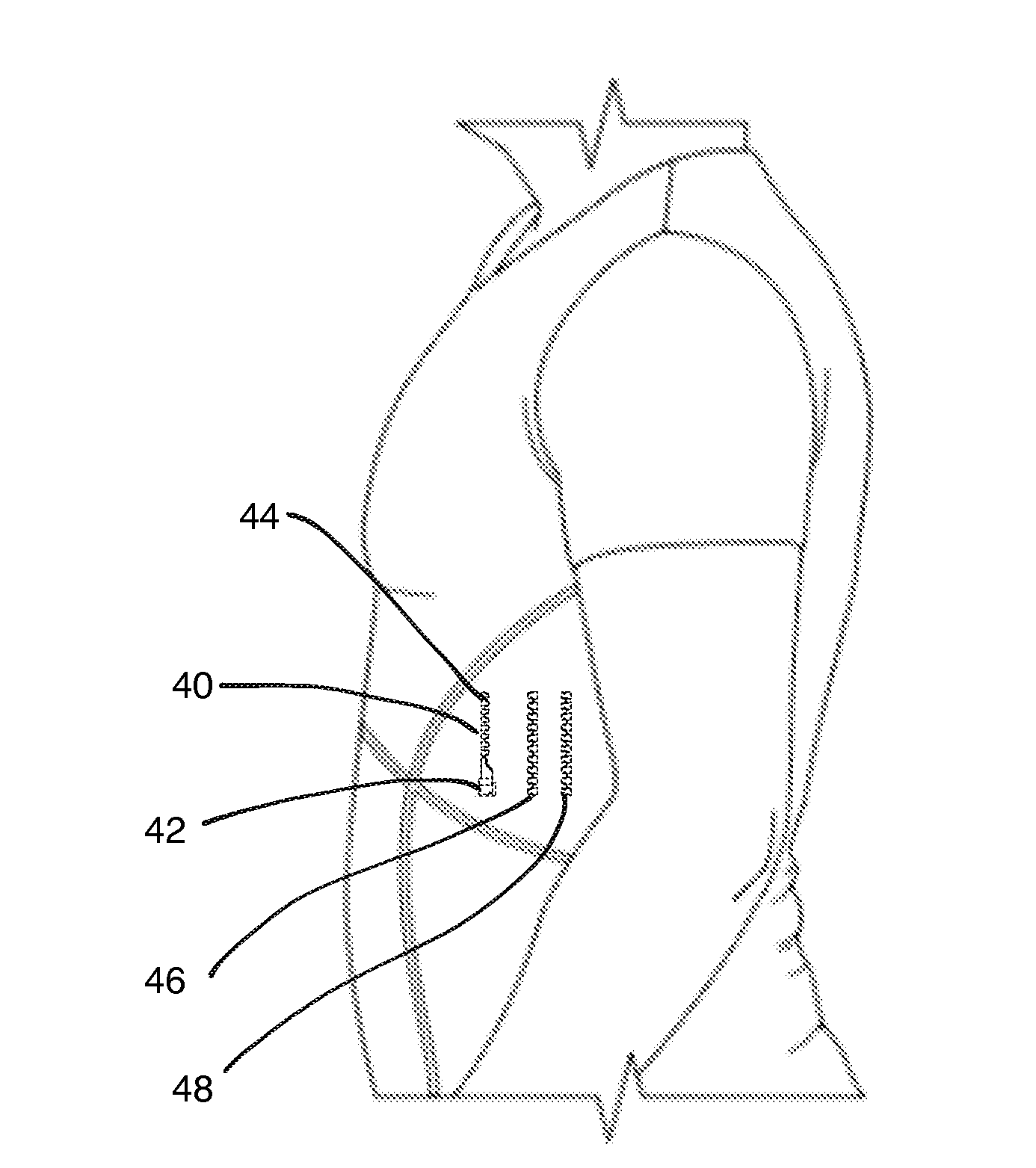 Noninvasive Method and Apparatus for Facilitating Weight Loss