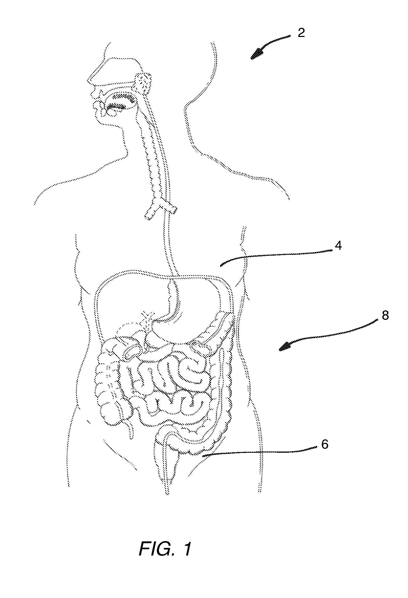 Noninvasive Method and Apparatus for Facilitating Weight Loss