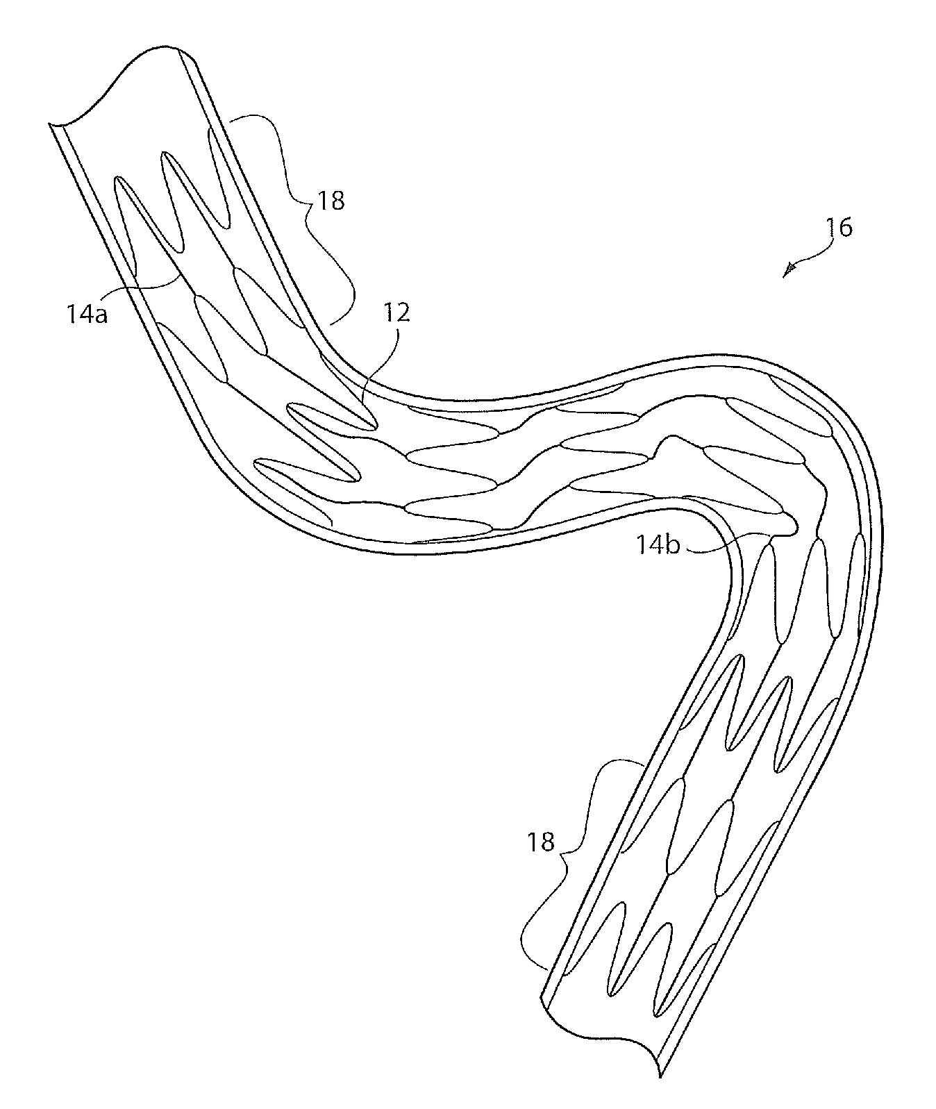 Implantable device