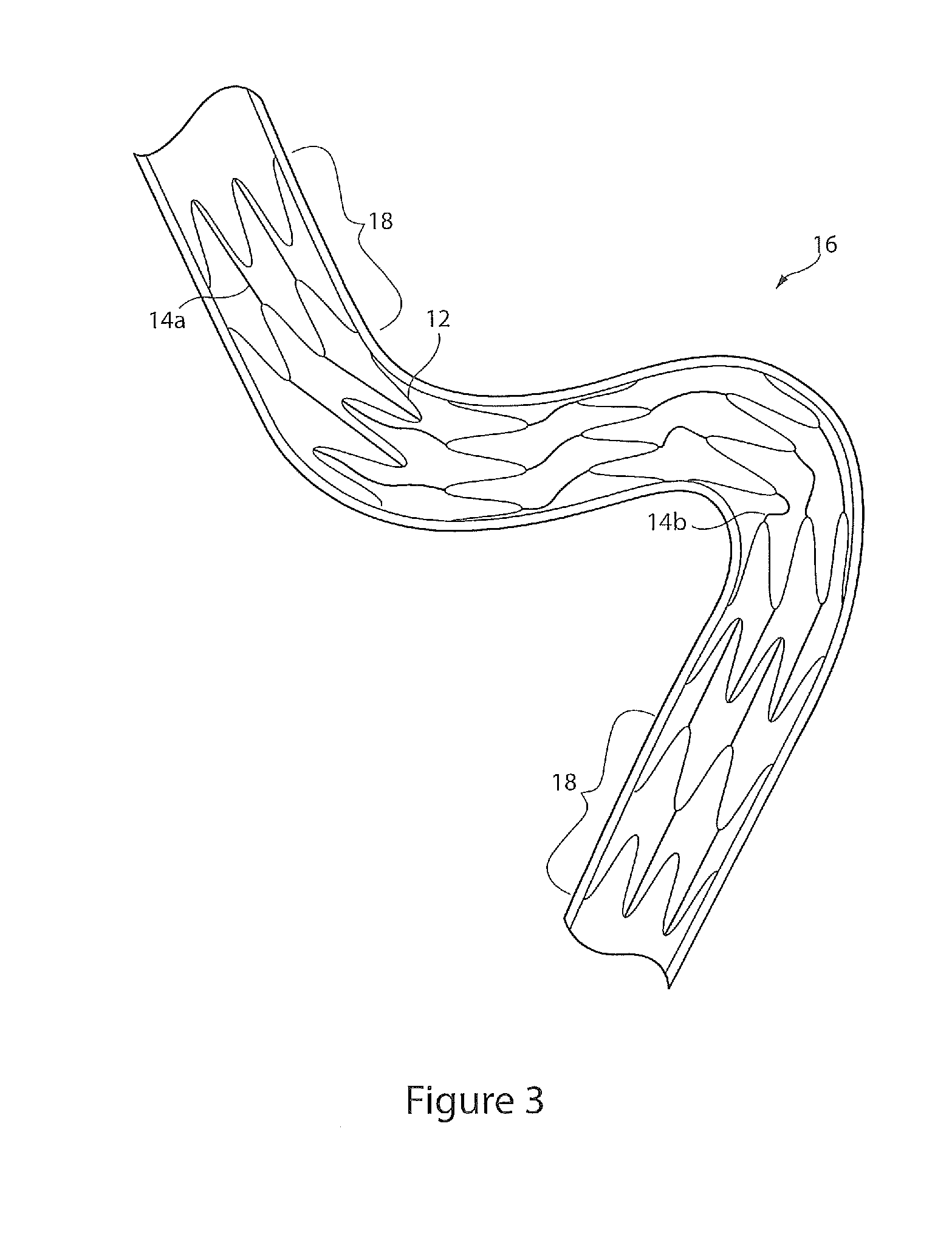 Implantable device