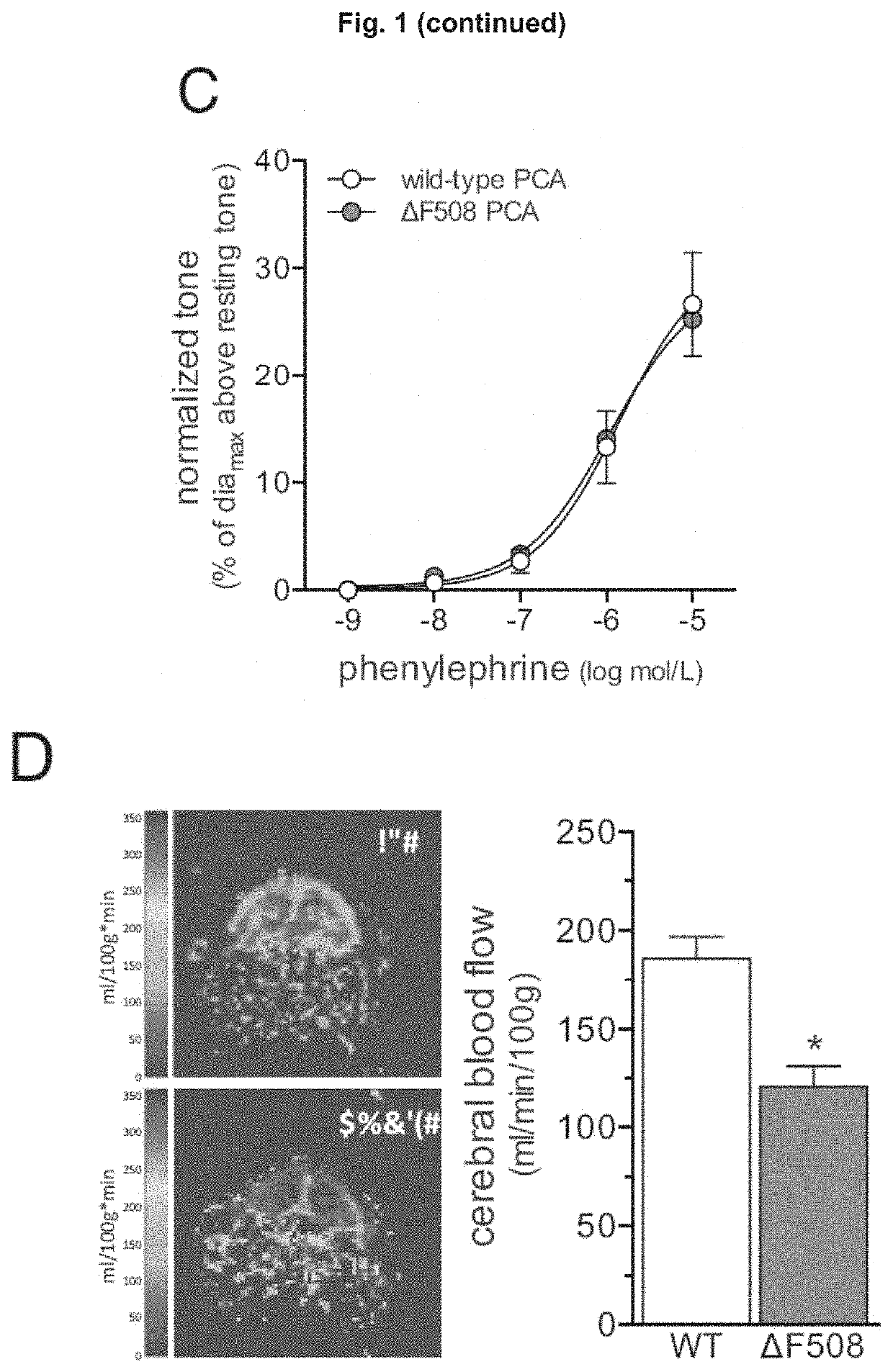 Use of CFTR Modulators For Treating Cerebrovascular Conditions