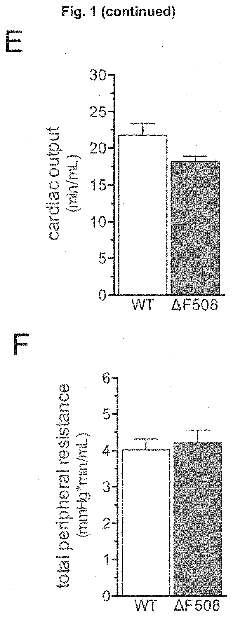 Use of CFTR Modulators For Treating Cerebrovascular Conditions