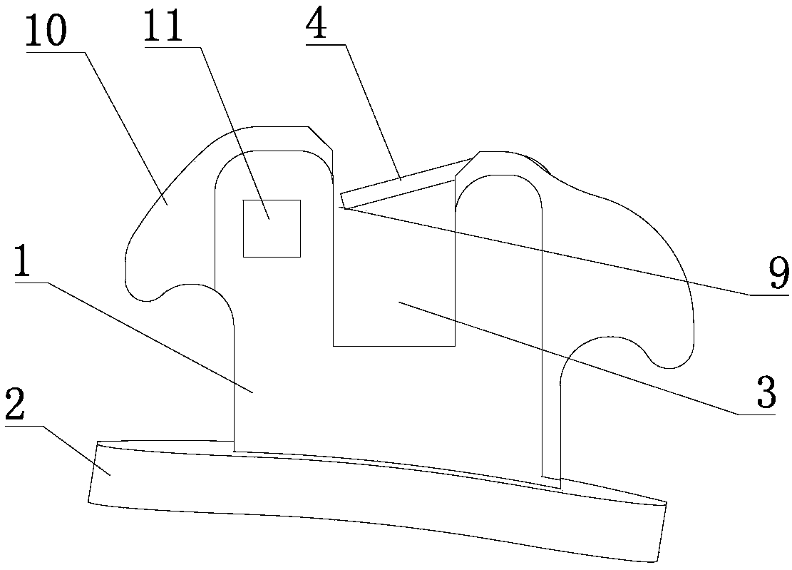 Orthodontic time-sharing self-locking bracket