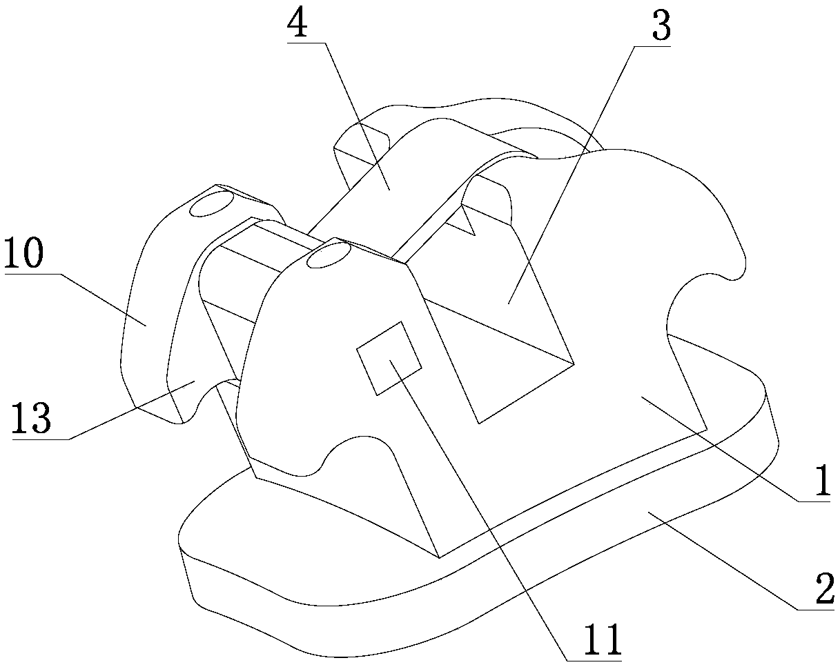 Orthodontic time-sharing self-locking bracket