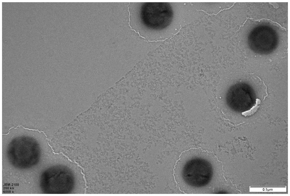 A kind of thymosin β-4 ethosome and its preparation process