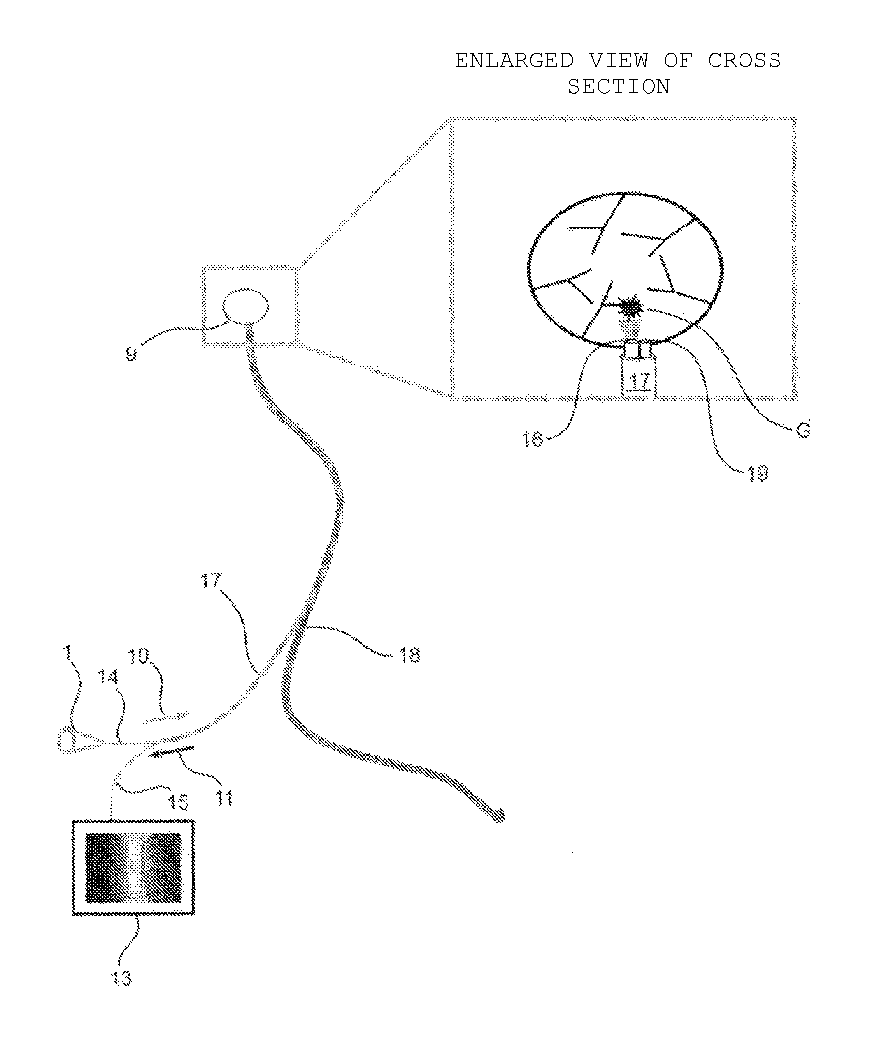 Device for determining metastasis of cancer to sentinel lymph node