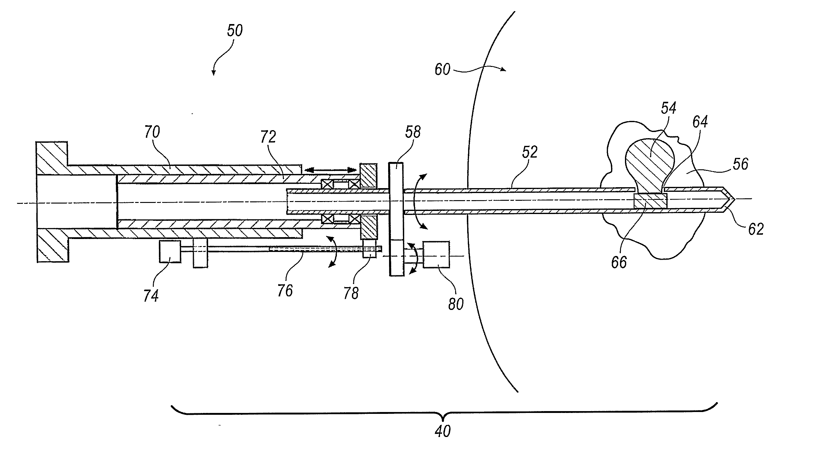 Image-Guided Intensity-Modulated X-Ray Brachytherapy System