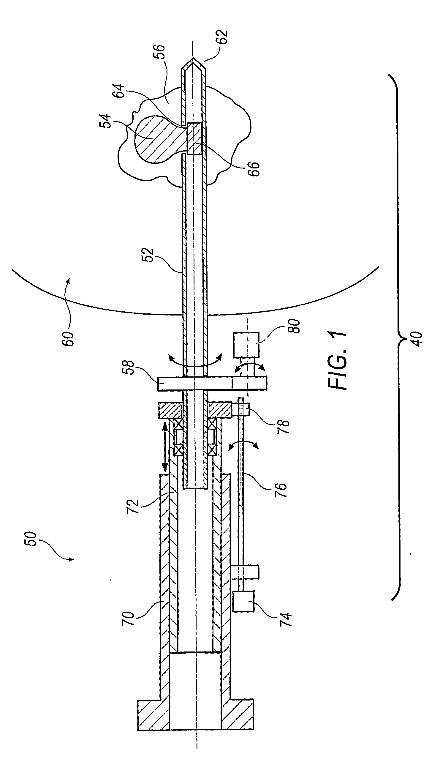 Image-Guided Intensity-Modulated X-Ray Brachytherapy System