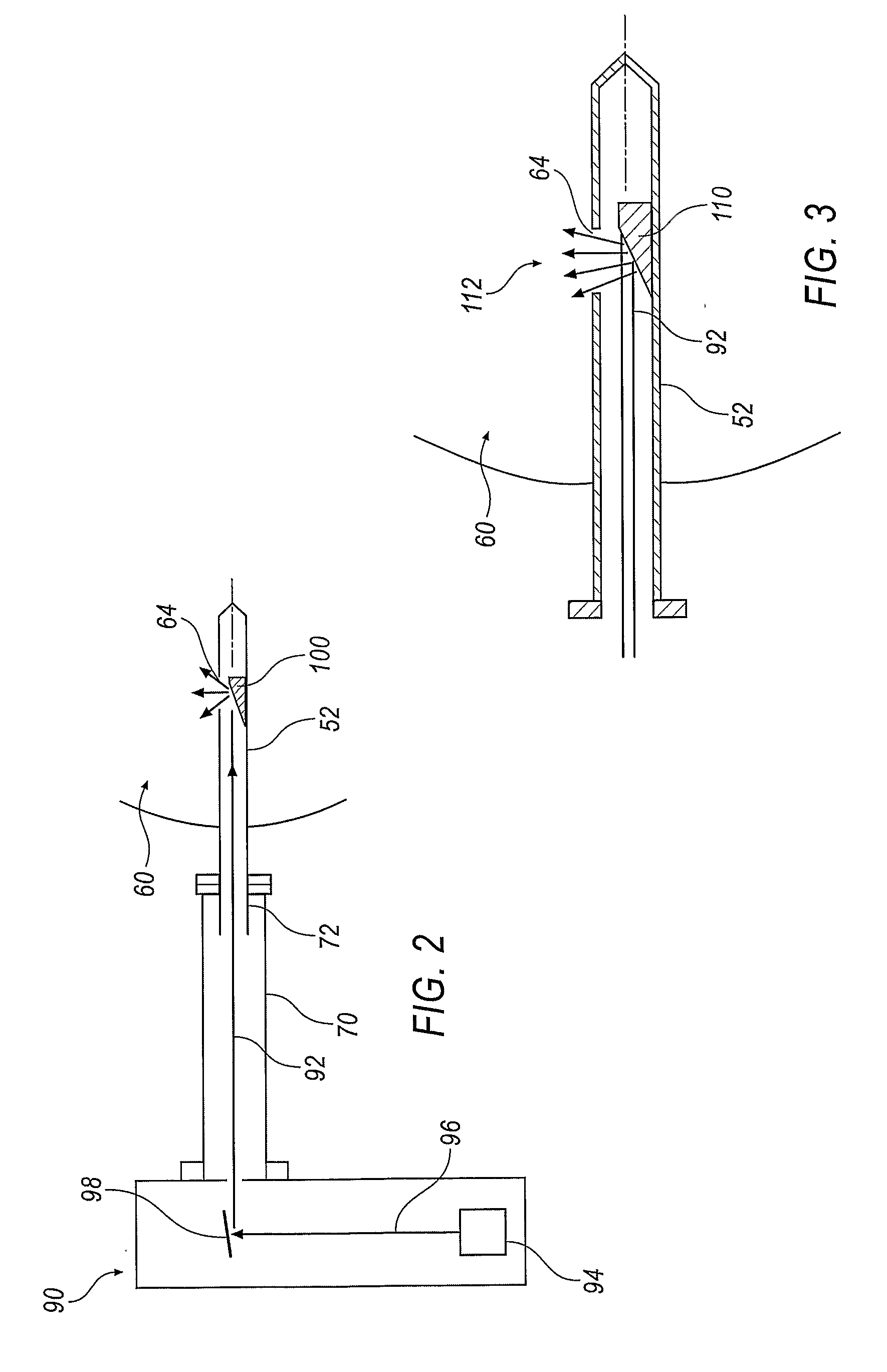 Image-Guided Intensity-Modulated X-Ray Brachytherapy System