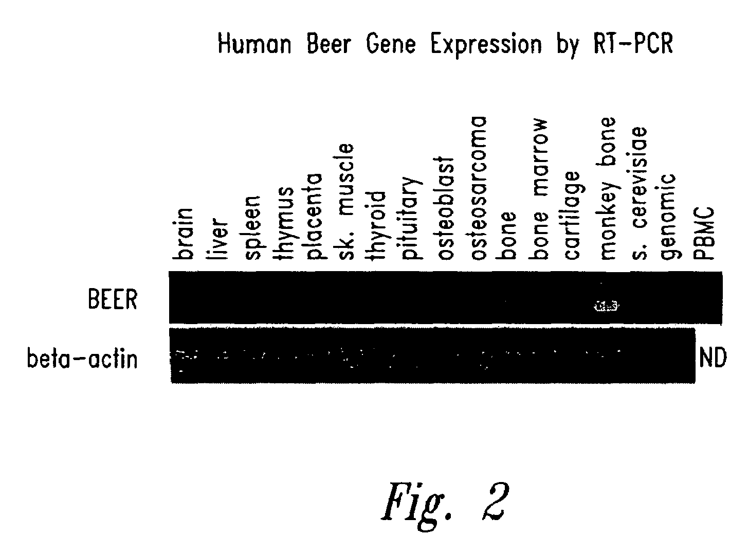 Antibodies specific for sclerostin