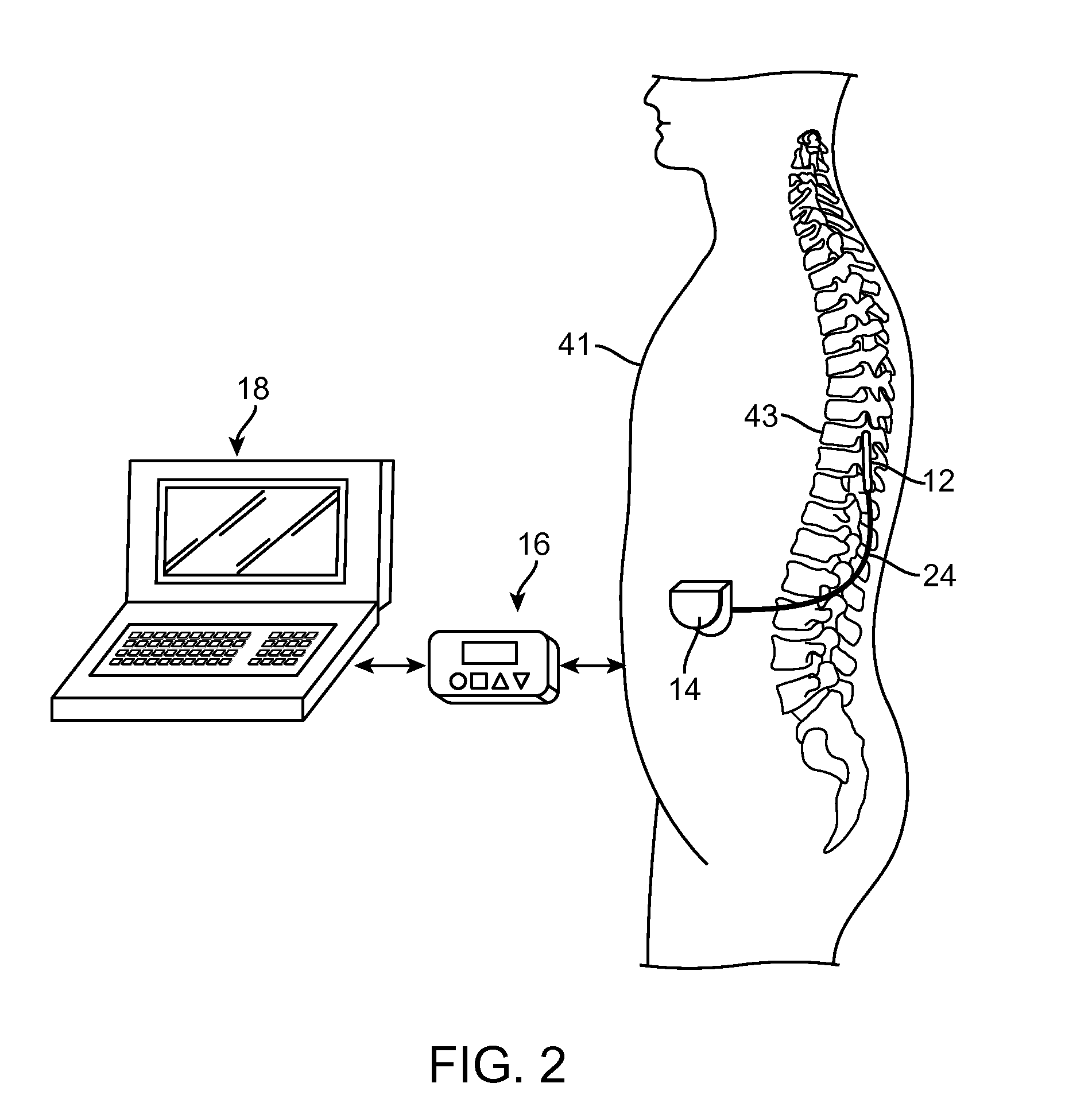 Method for treating depression by indirectly stimulating raphe nuclei