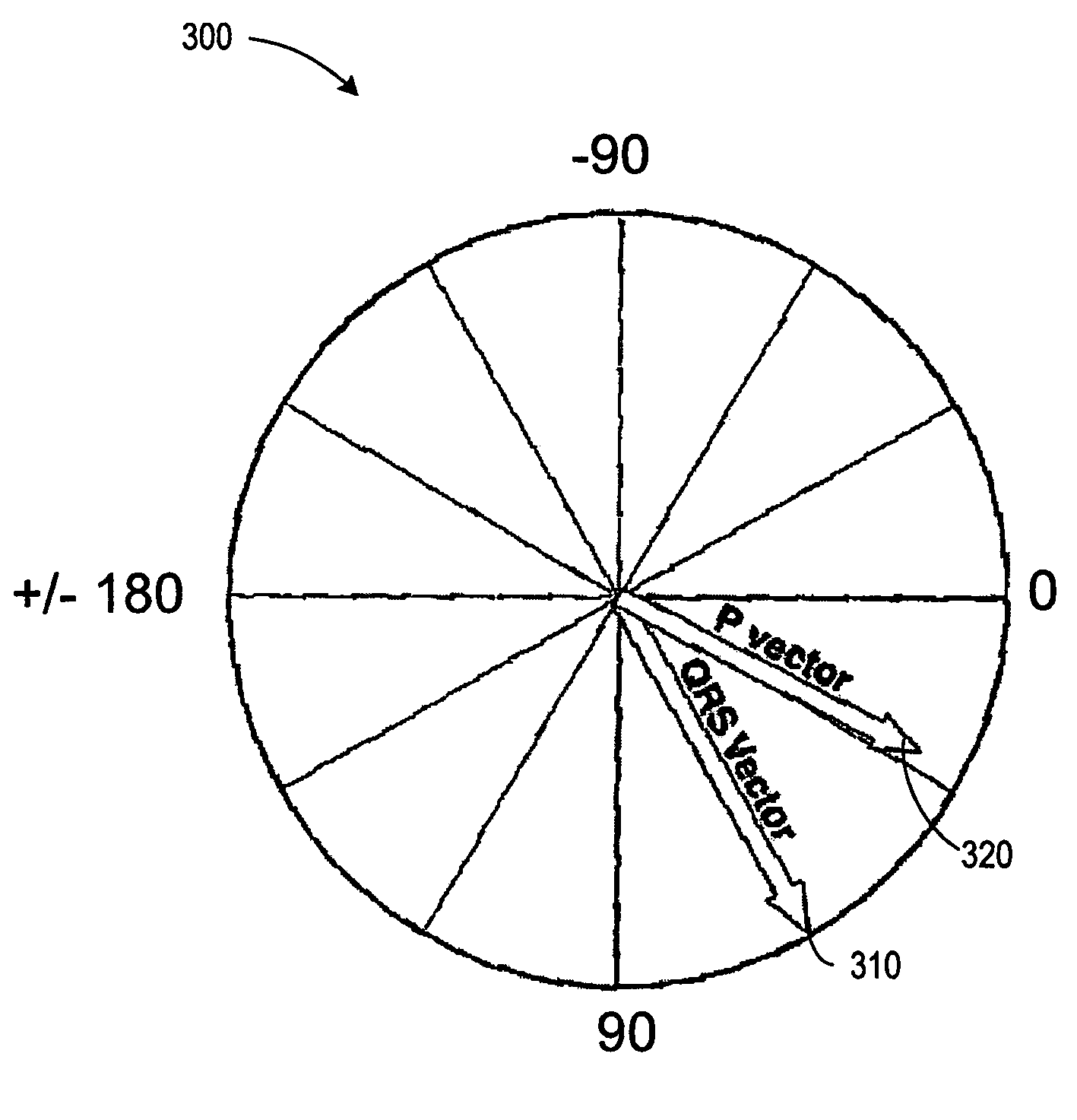 Closed loop cardiac resynchronization therapy using cardiac activation sequence information