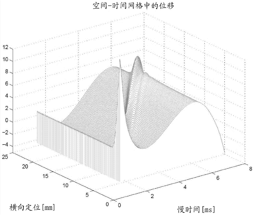 Motion independence in acoustic radiation force impulse imaging