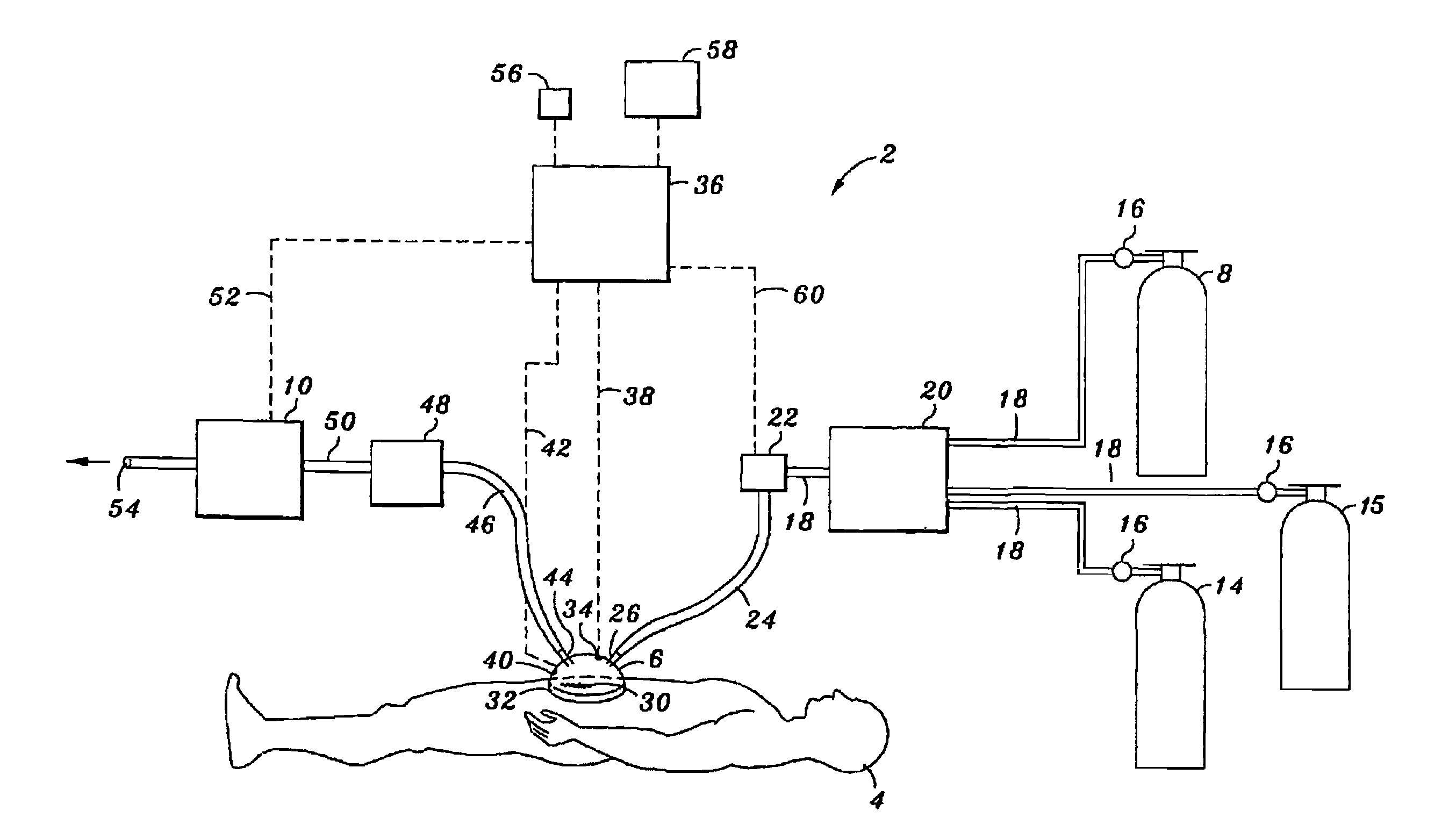 Methods of Treating An Infection with Nitric Oxide