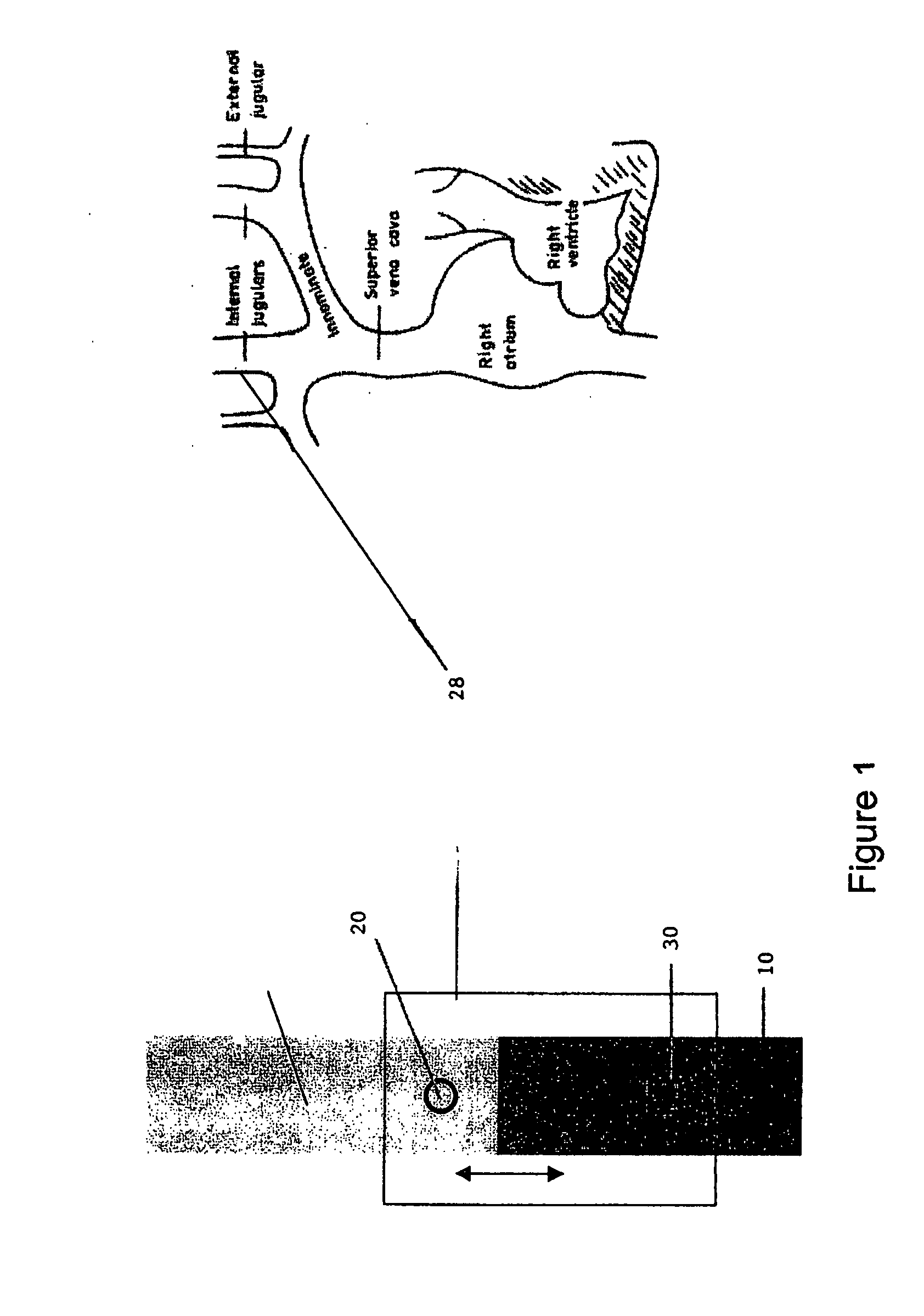 Method and device for measuring parameters of cardiac function