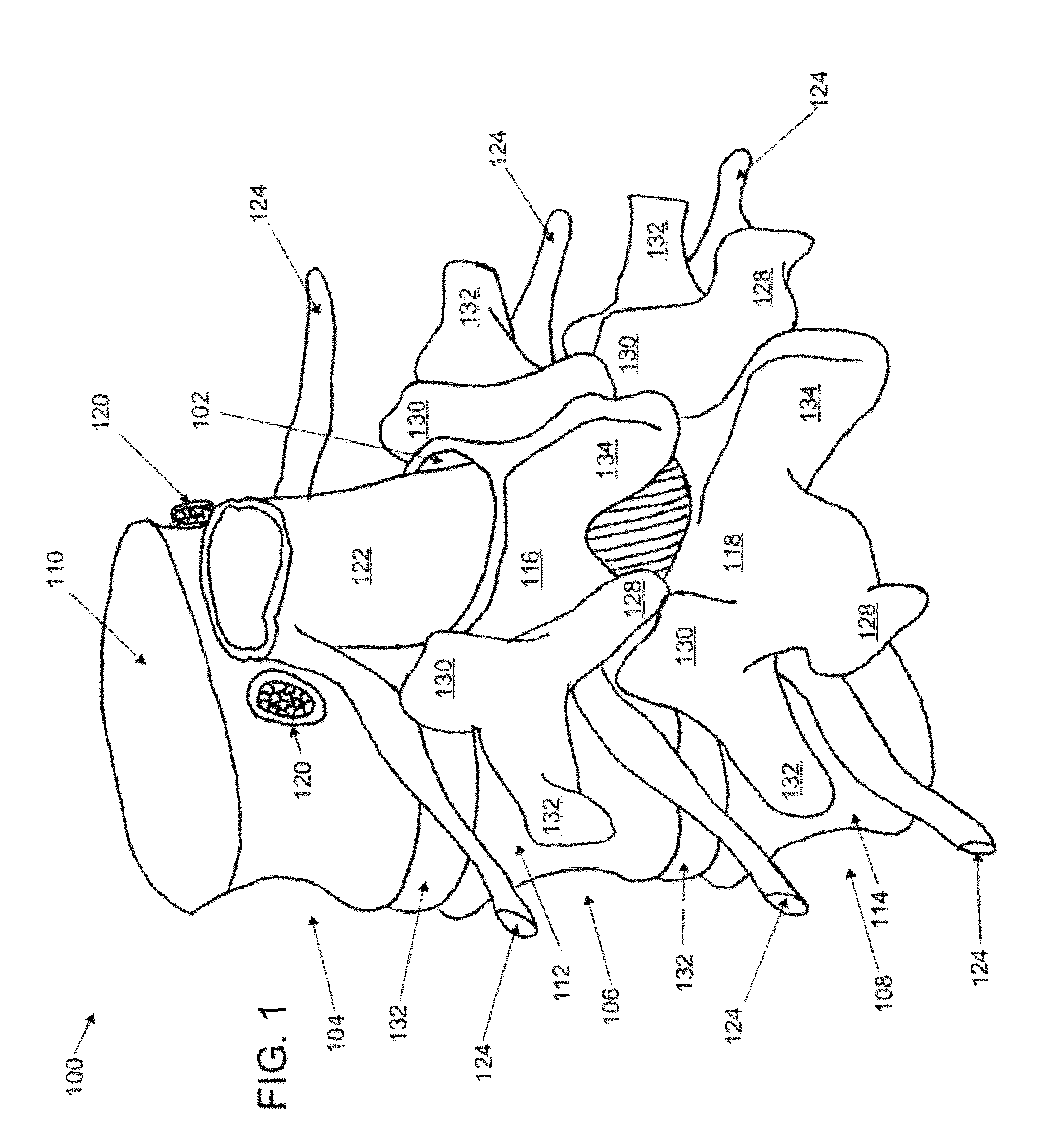 Cannulotome