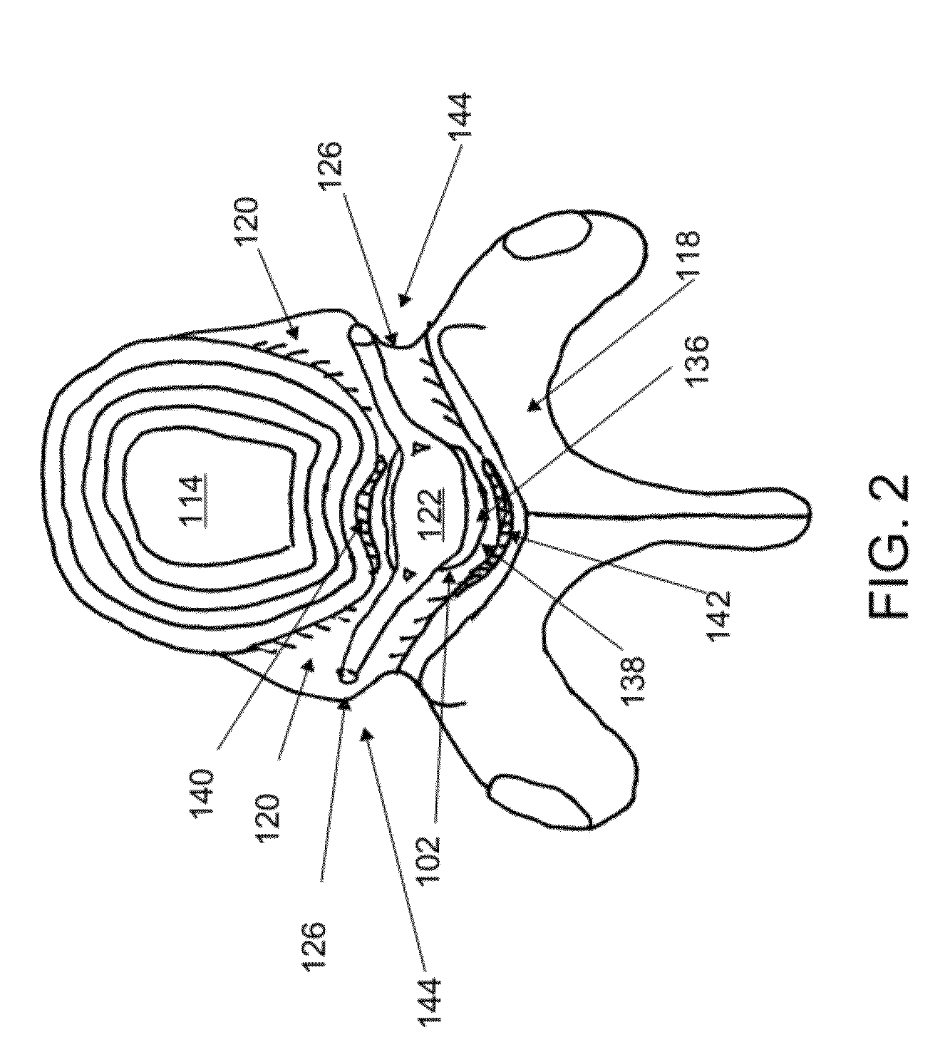 Cannulotome