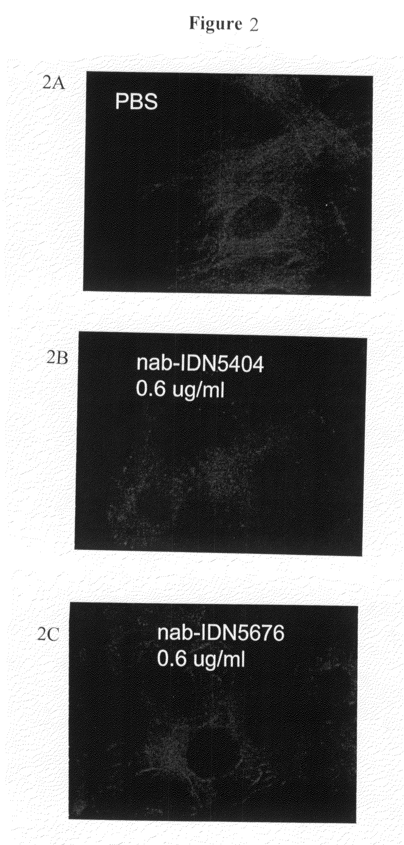 Methods of inhibiting angiogenesis and treating angiogenesis-associated diseases