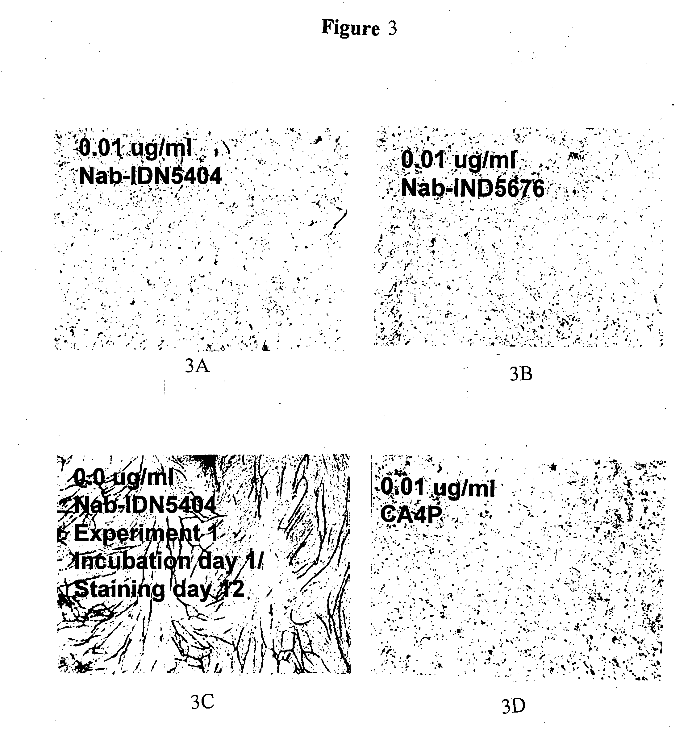 Methods of inhibiting angiogenesis and treating angiogenesis-associated diseases