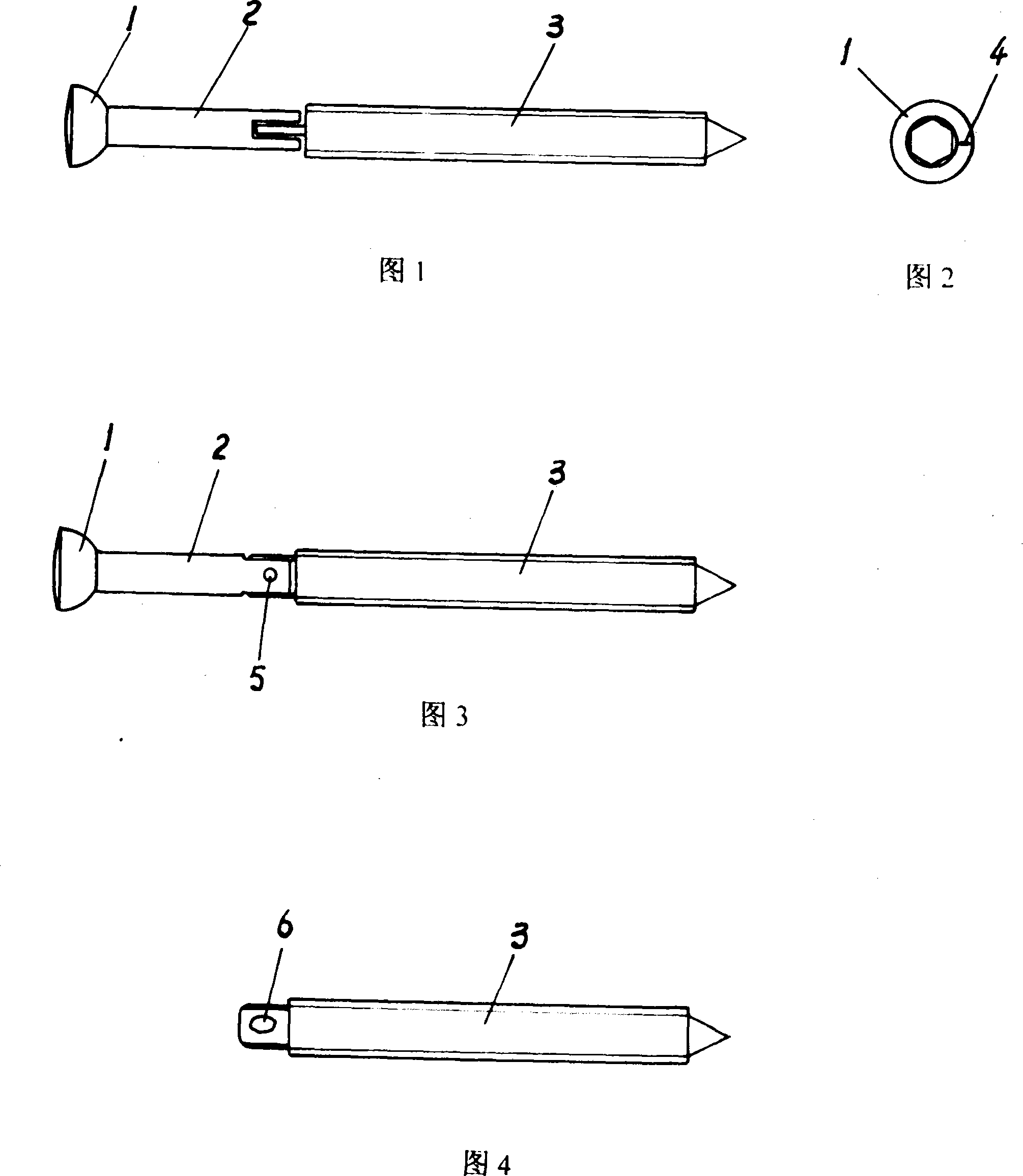 Medical jiggle lag screw for medicine