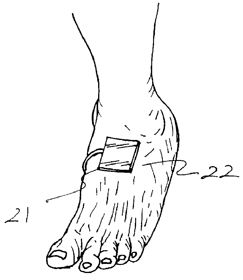 System for providing thermal application to external body areas of a patient