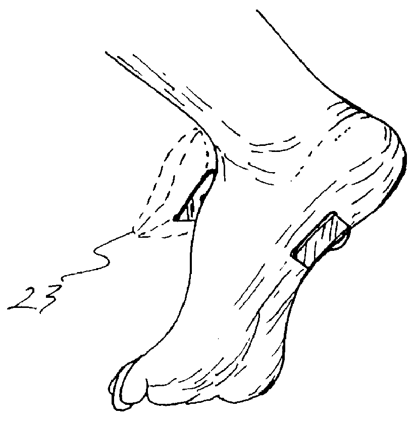 System for providing thermal application to external body areas of a patient