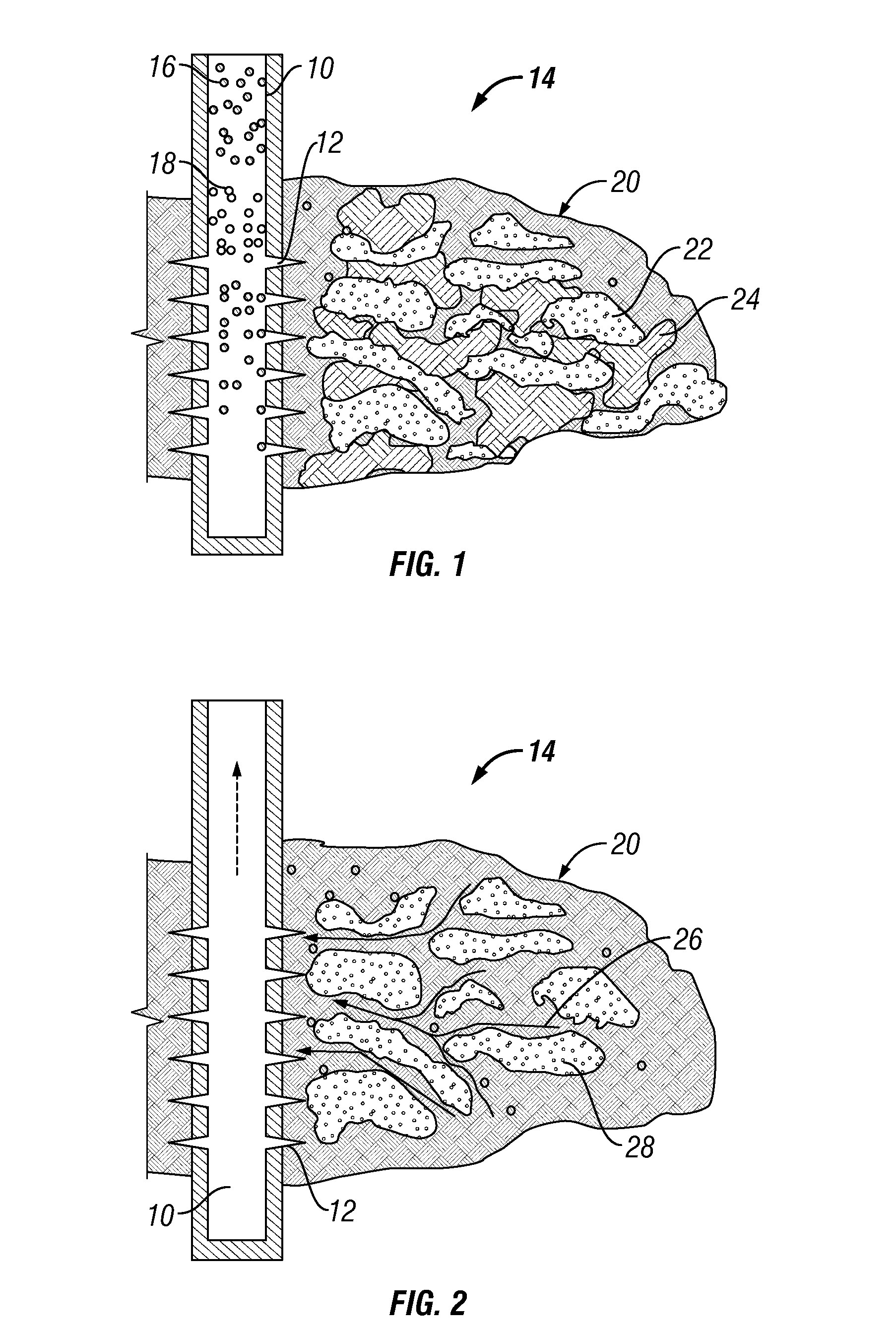 Heterogeneous proppant placement in a fracture with removable channelant fill