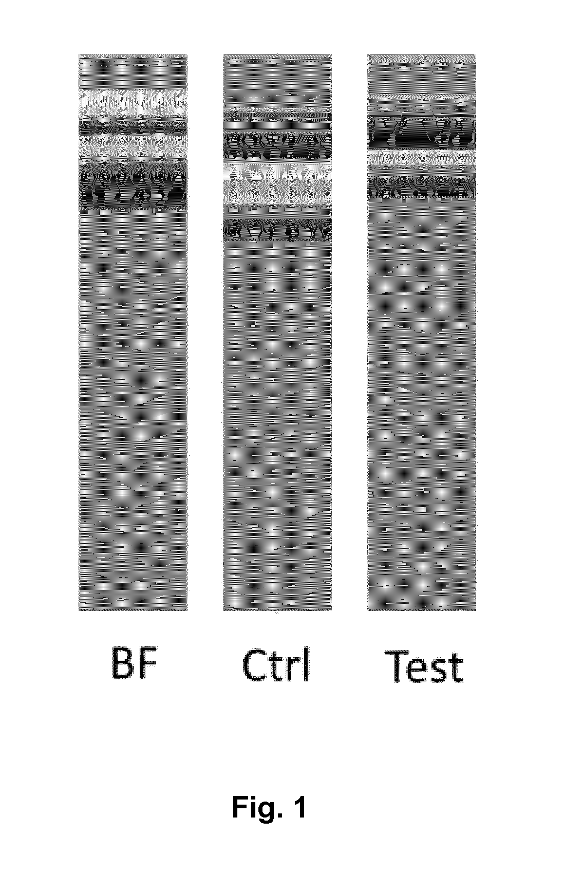 Nutritional compositions with 2fl and lnnt for use in inducing a gut microbiota close to the one of breast fed infants