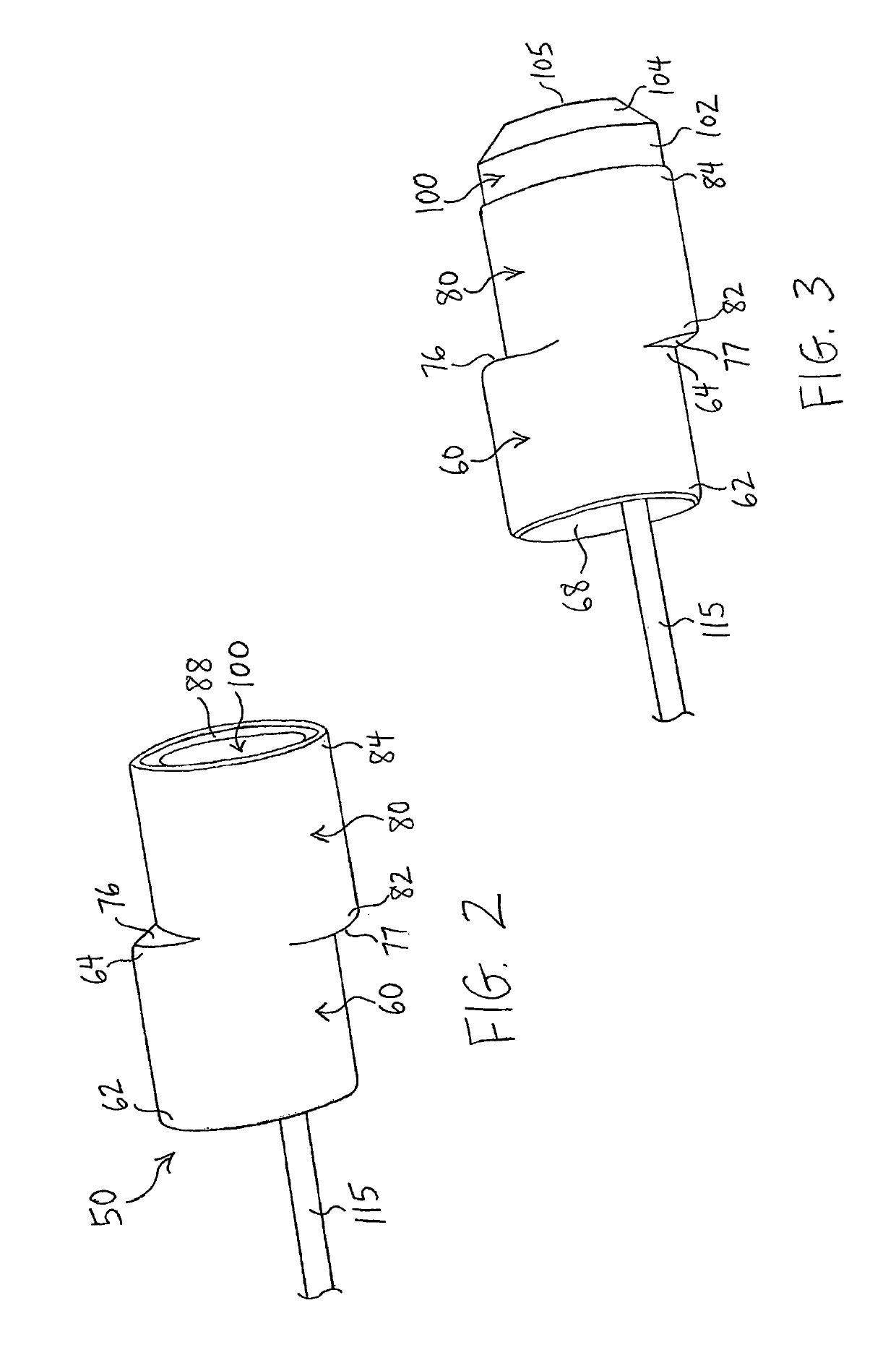 Endoscopic system for resection of tissue