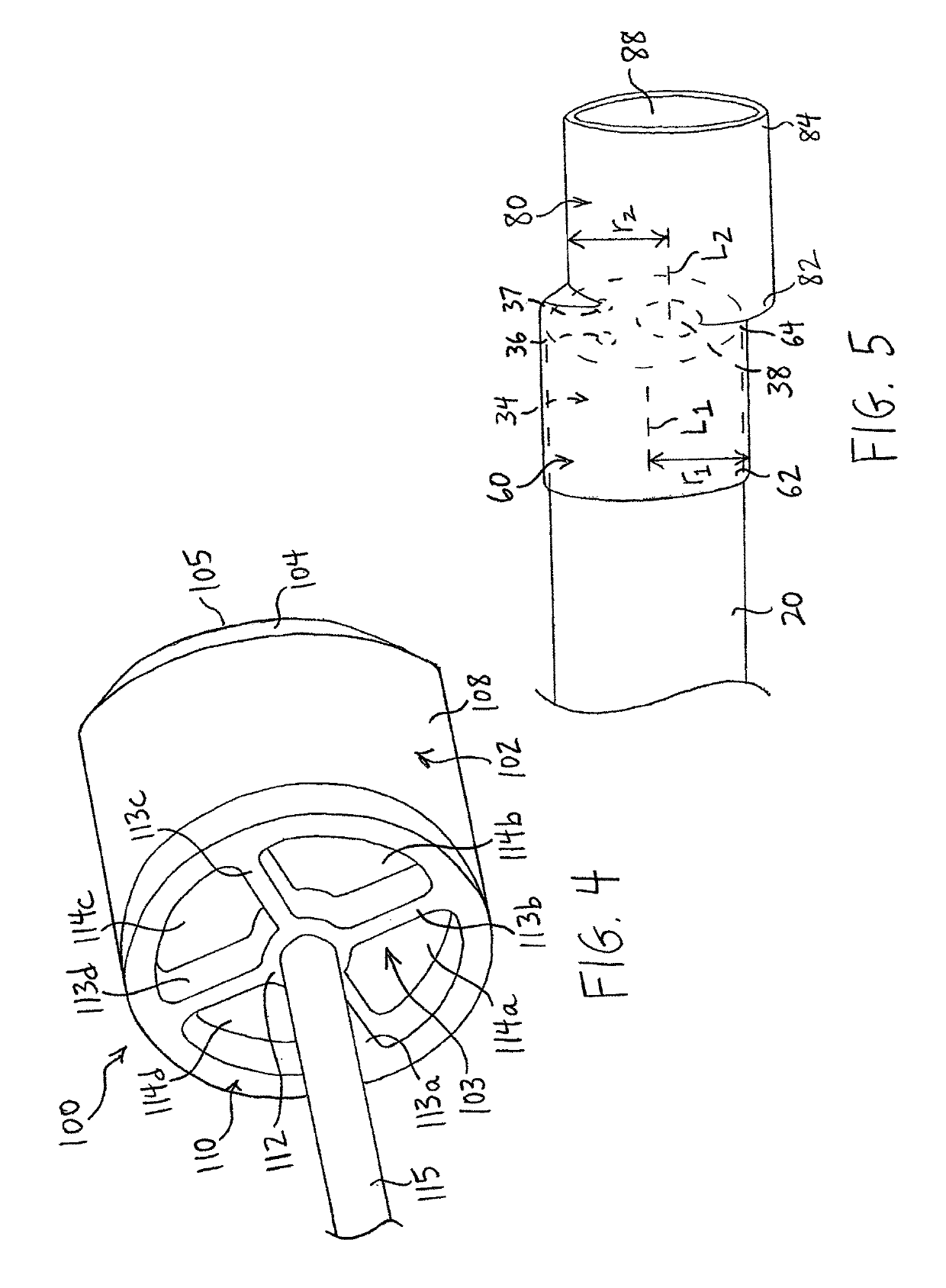 Endoscopic system for resection of tissue