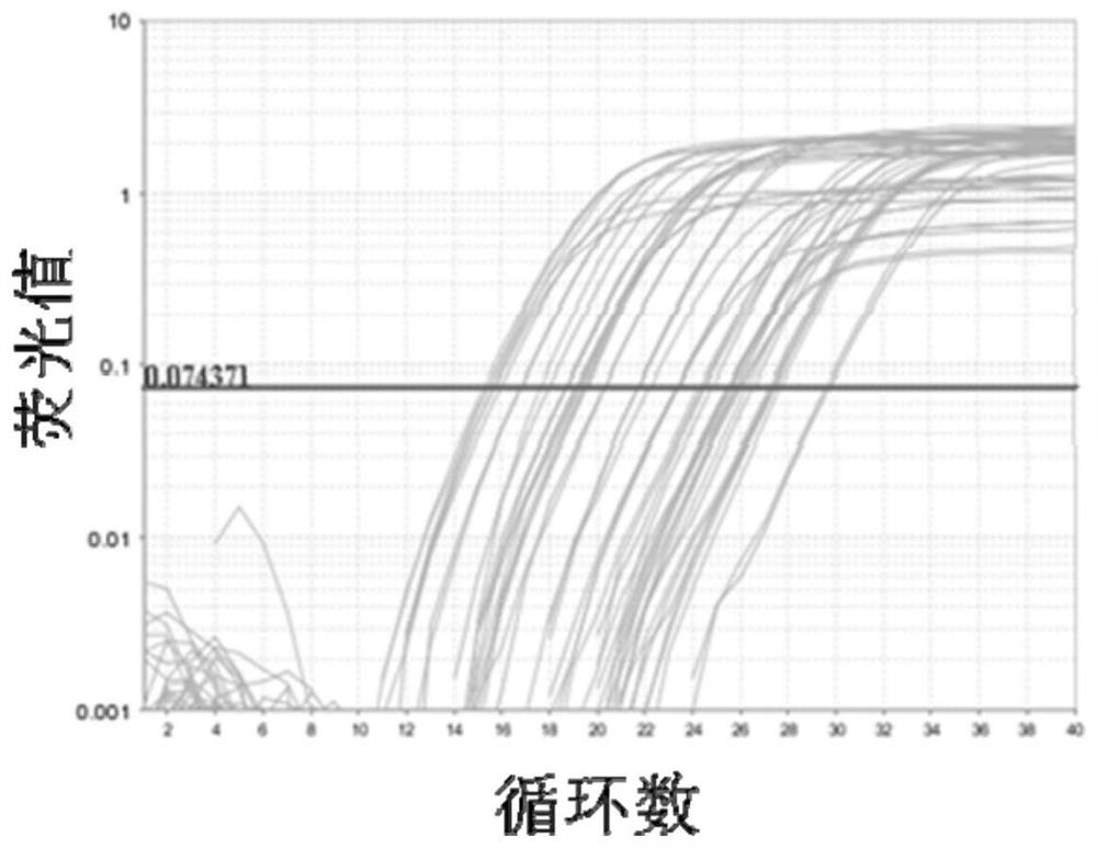 Application of specific primers of clc gene in preparation of kit for detection of subtypes of chronic sinusitis with nasal polyps