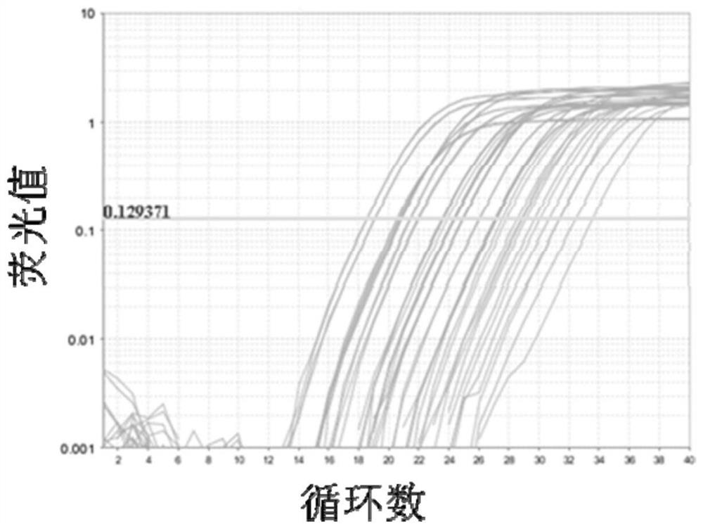 Application of specific primers of clc gene in preparation of kit for detection of subtypes of chronic sinusitis with nasal polyps