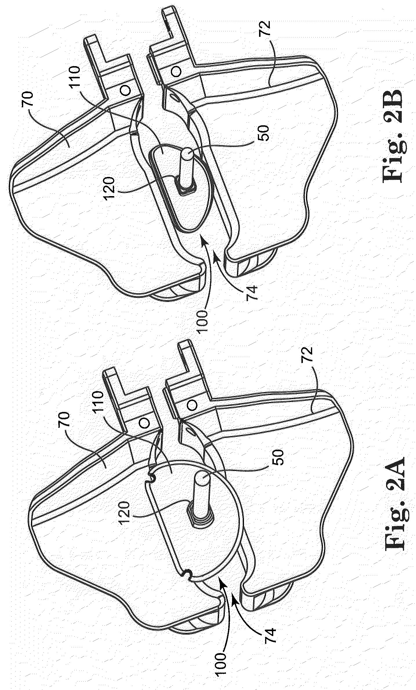 Deformable Sizer and Holder Devices for Minimally Invasive Cardiac Surgery