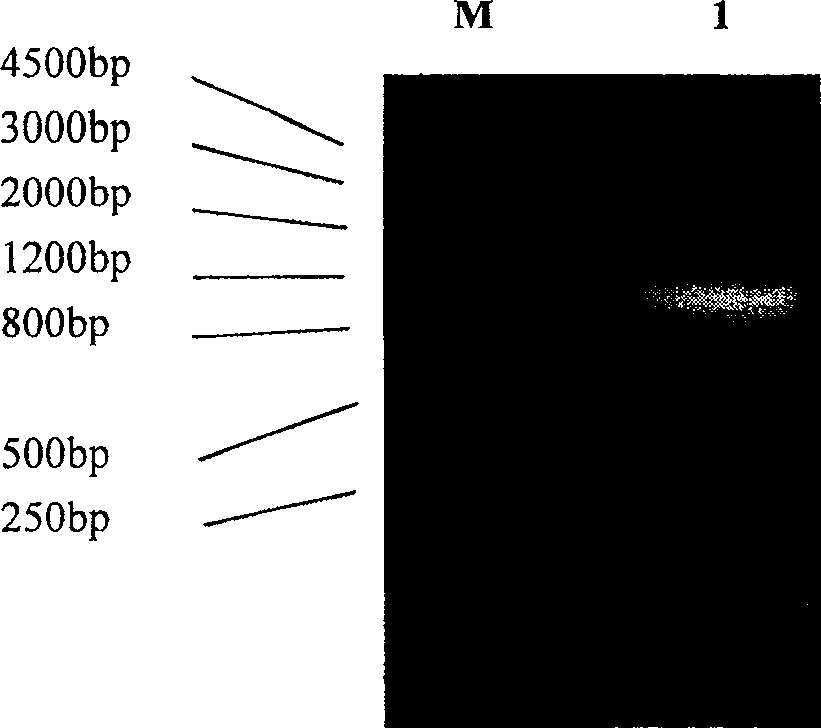 Ethyl chrysanthemate esterase and coding gene and specific engineering baterium for expression and uses of the enzyme