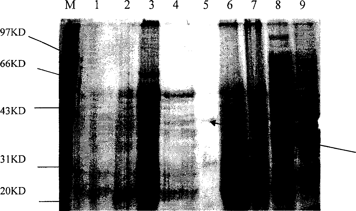 Ethyl chrysanthemate esterase and coding gene and specific engineering baterium for expression and uses of the enzyme