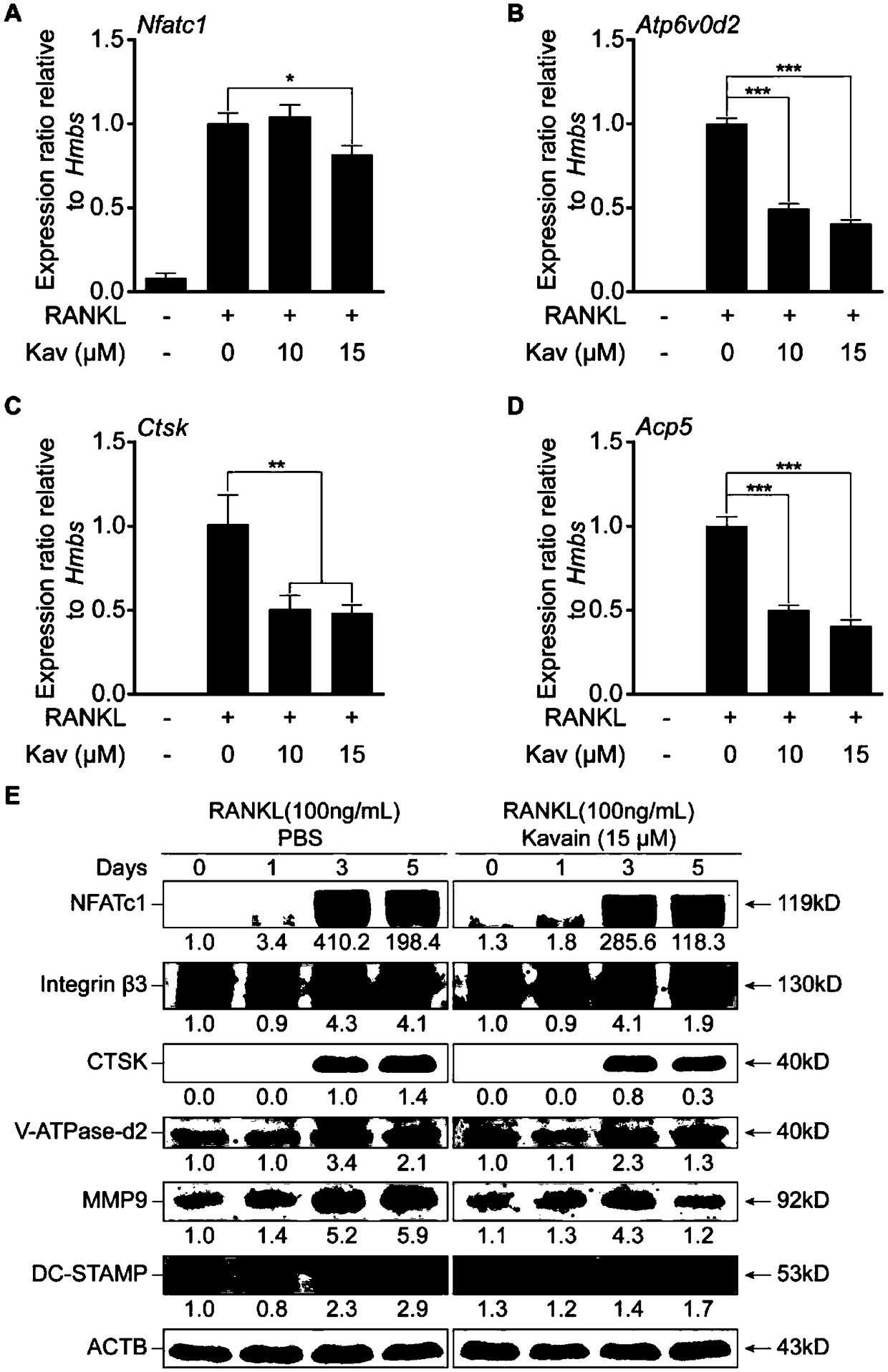 Application of kavain in preparing drug for treating osteoporosis