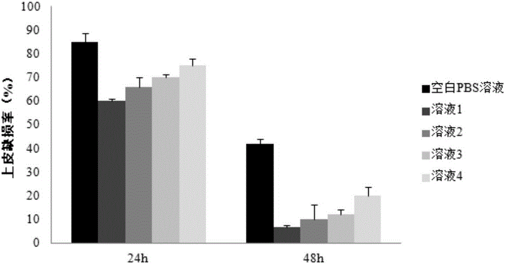 Curcumin micelle nasal solution and preparation method thereof