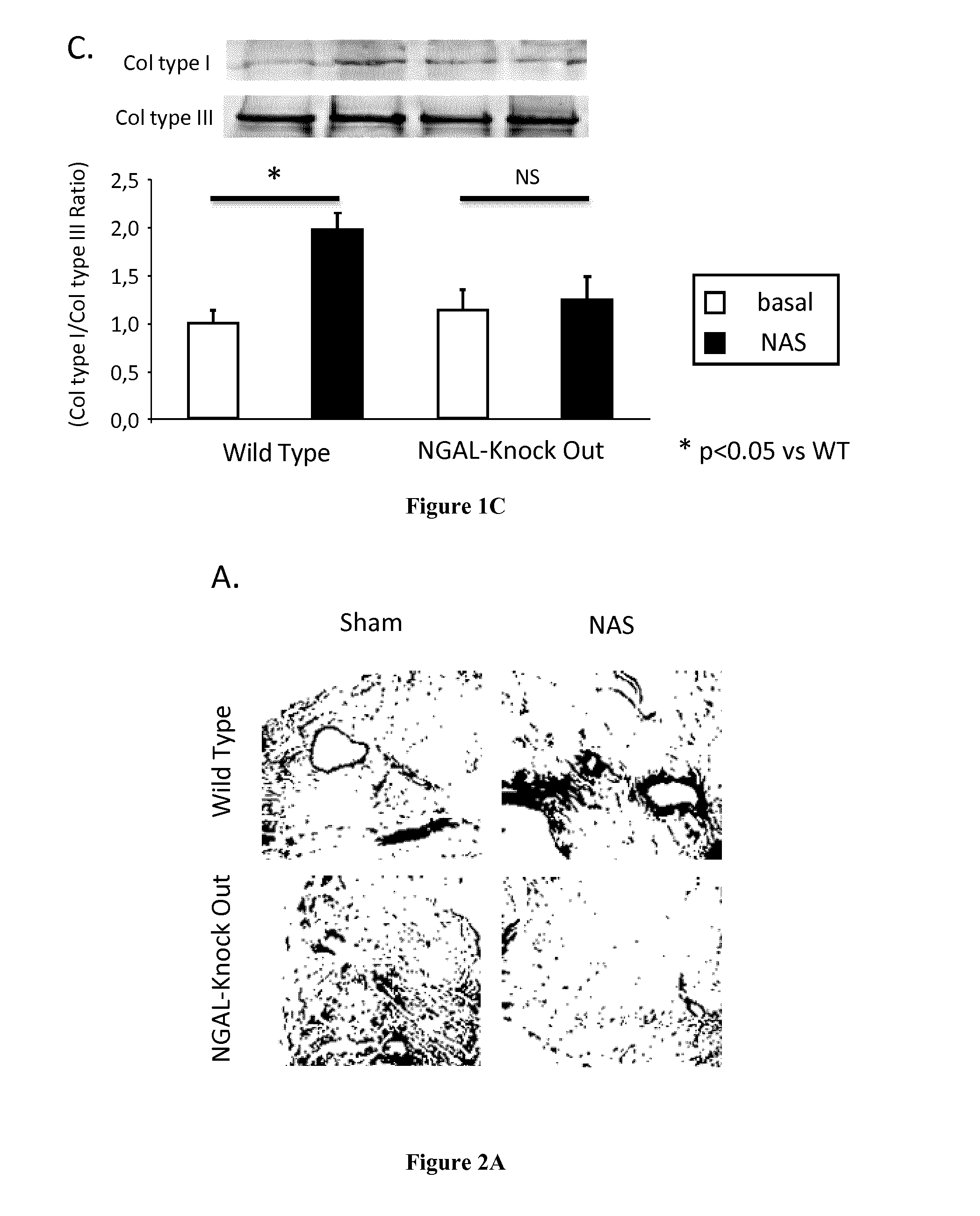 Methods and Pharmaceutical Compositions for the Treatment of Cardiovascular Fibrosis