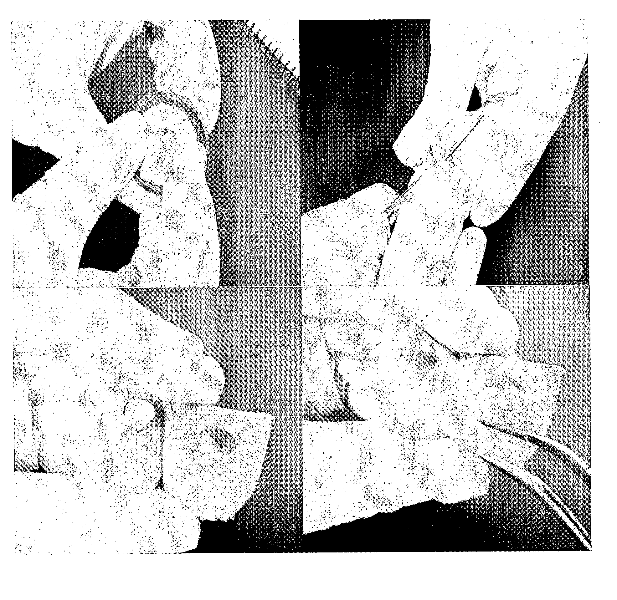 Use of Stem Cells, Method of Tissue Engineering, Use of Dental Tissues and Tooth Biological Substitute