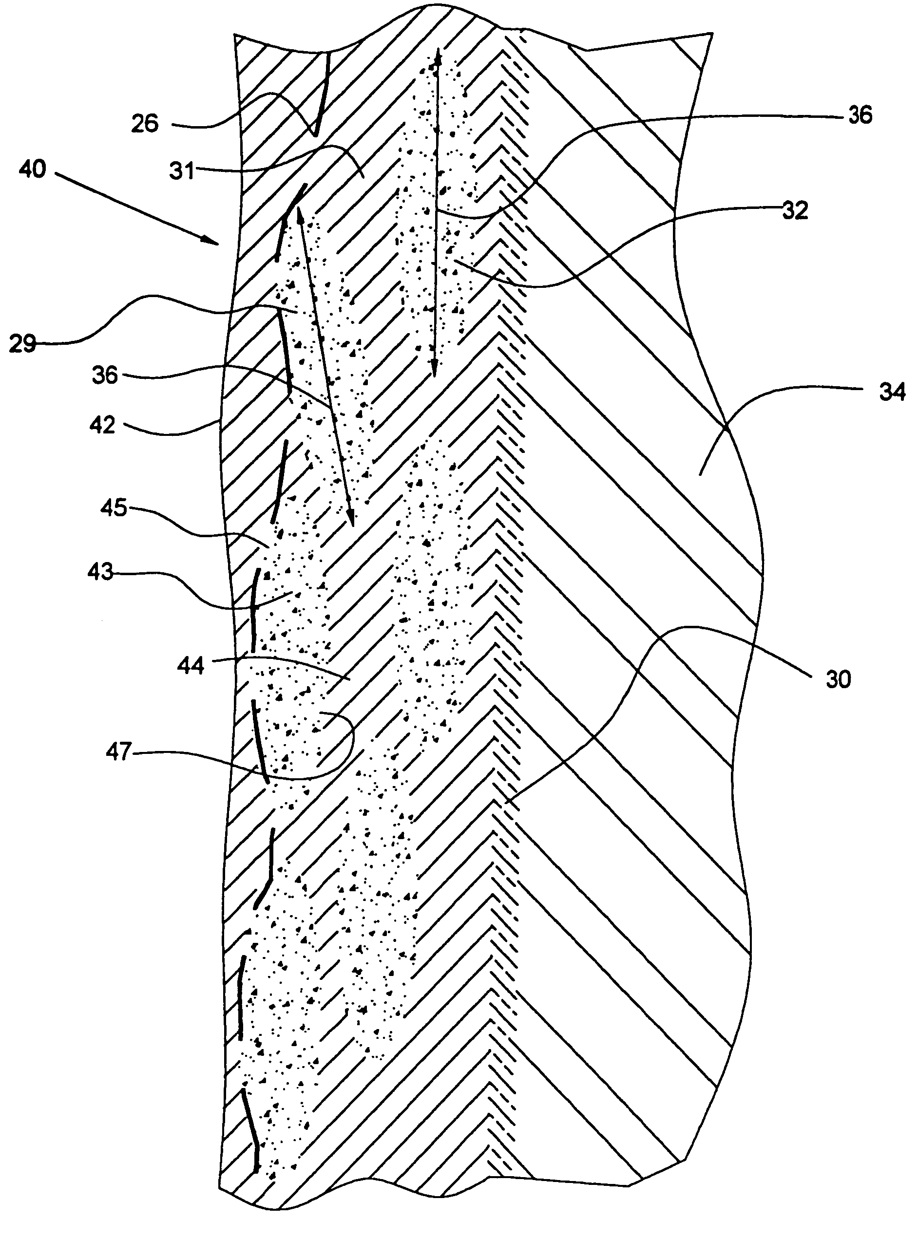 Heterogeneous composite bodies with isolated lenticular shaped cermet regions