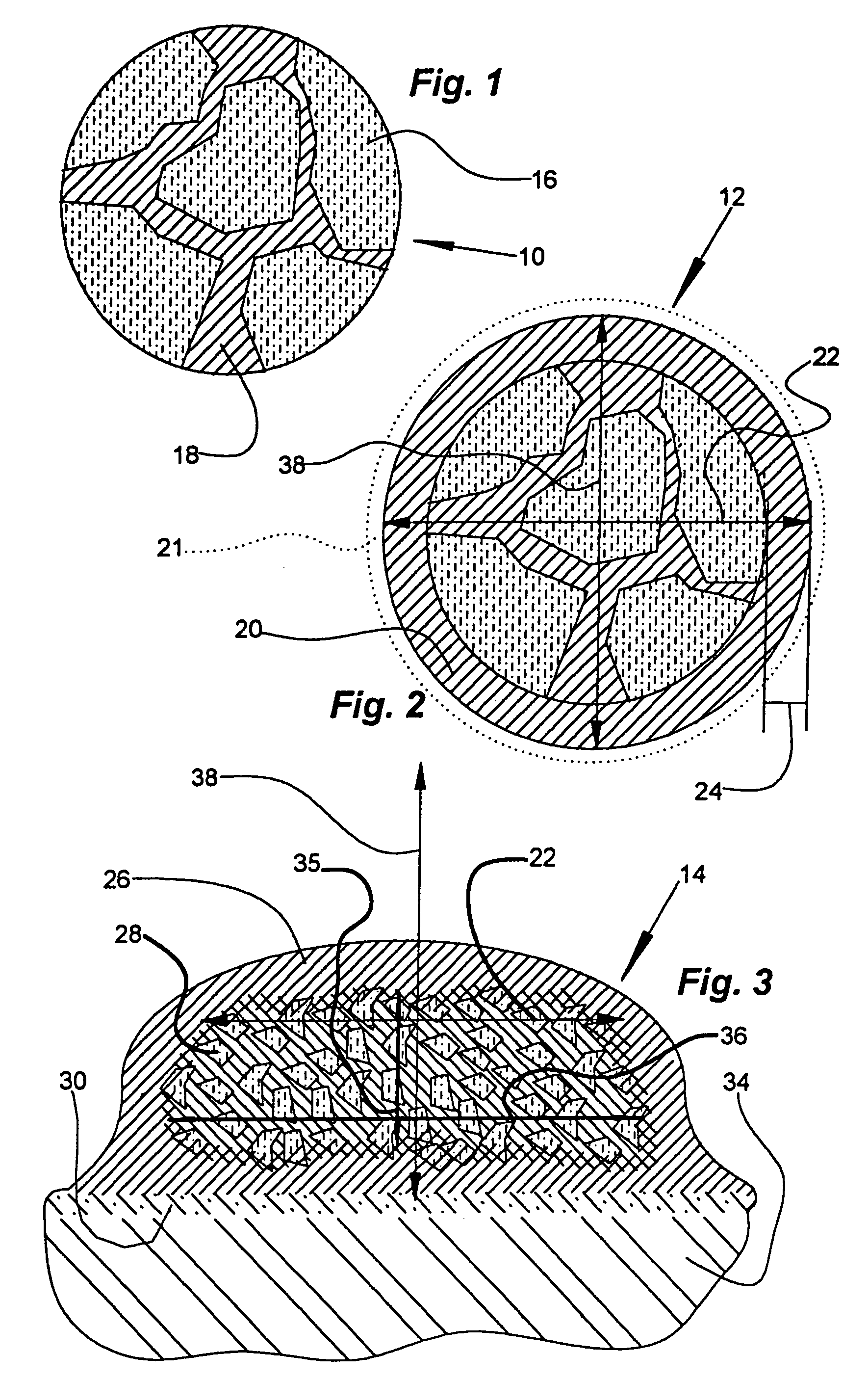 Heterogeneous composite bodies with isolated lenticular shaped cermet regions