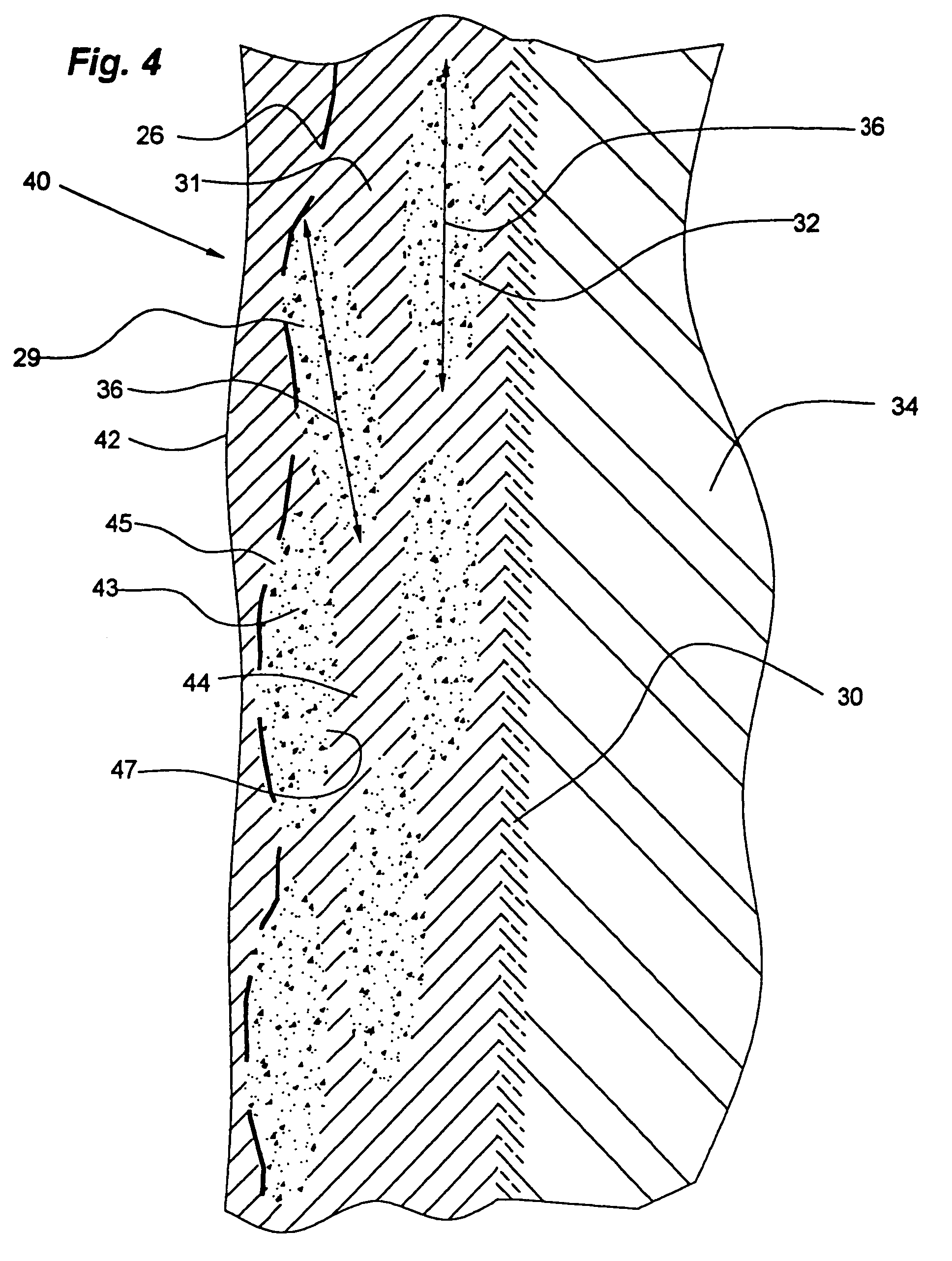 Heterogeneous composite bodies with isolated lenticular shaped cermet regions