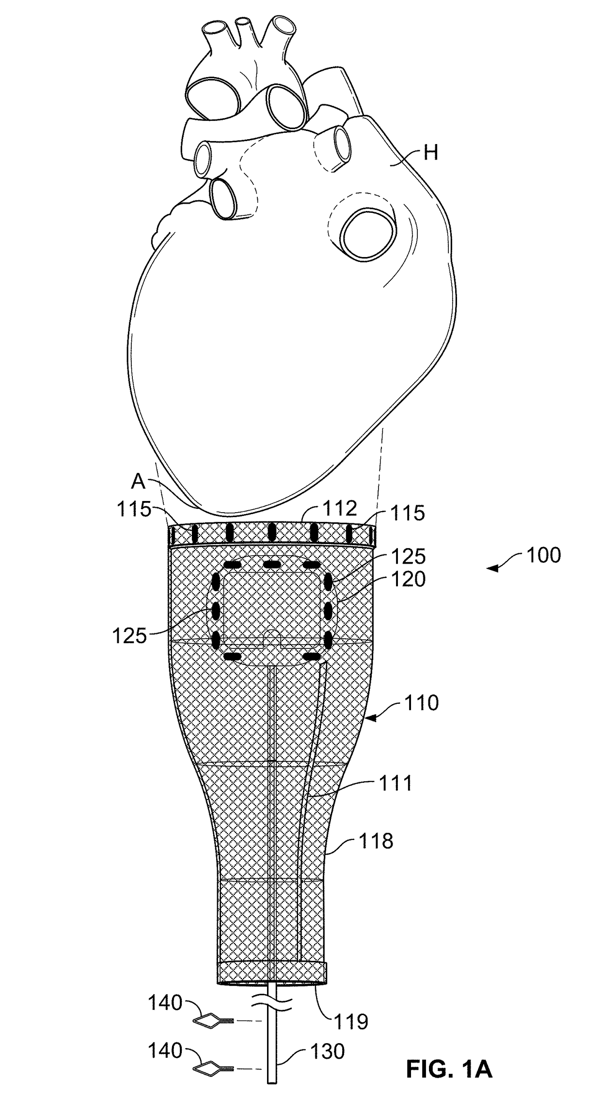 Cardiac treatment system and method