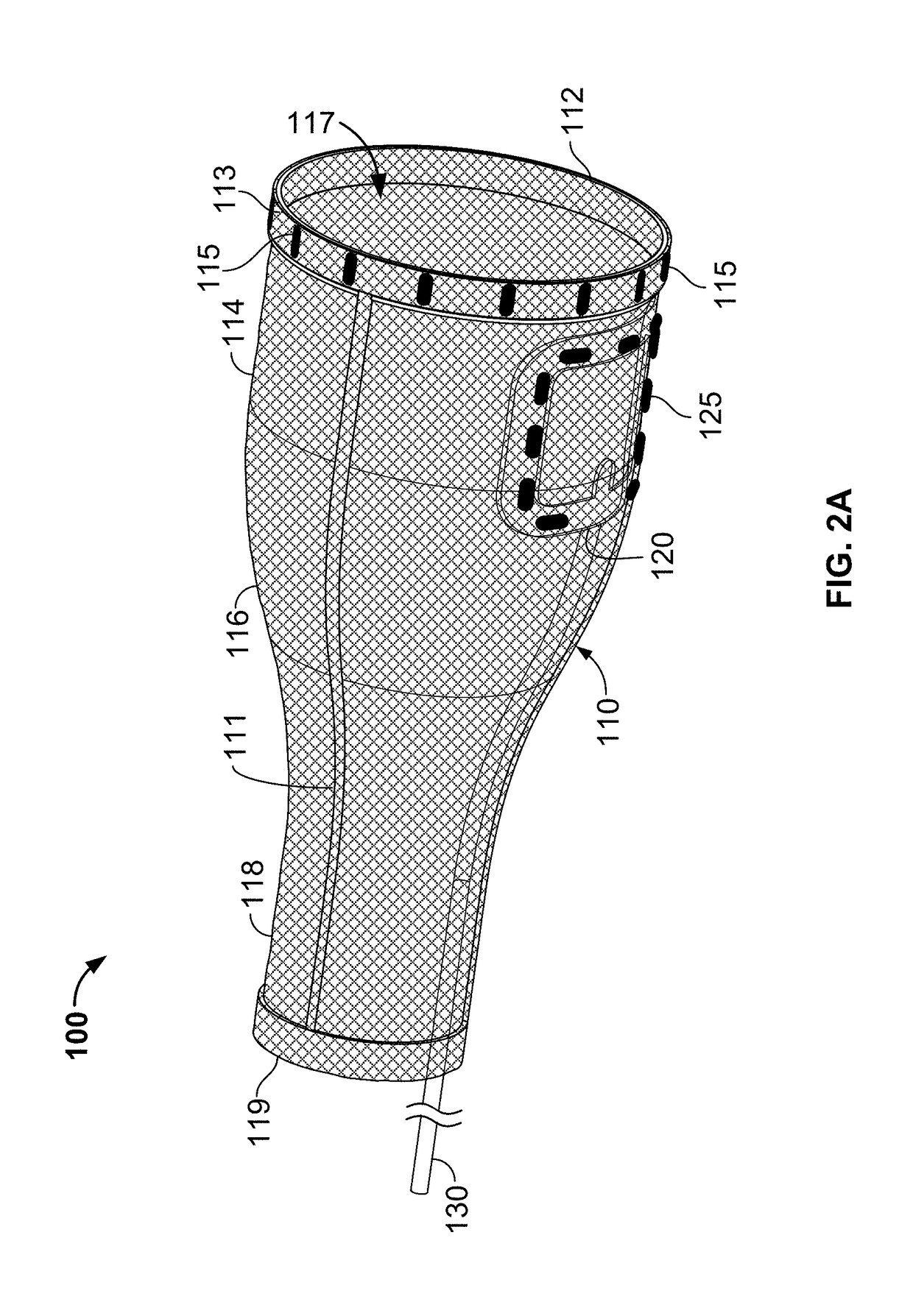 Cardiac treatment system and method