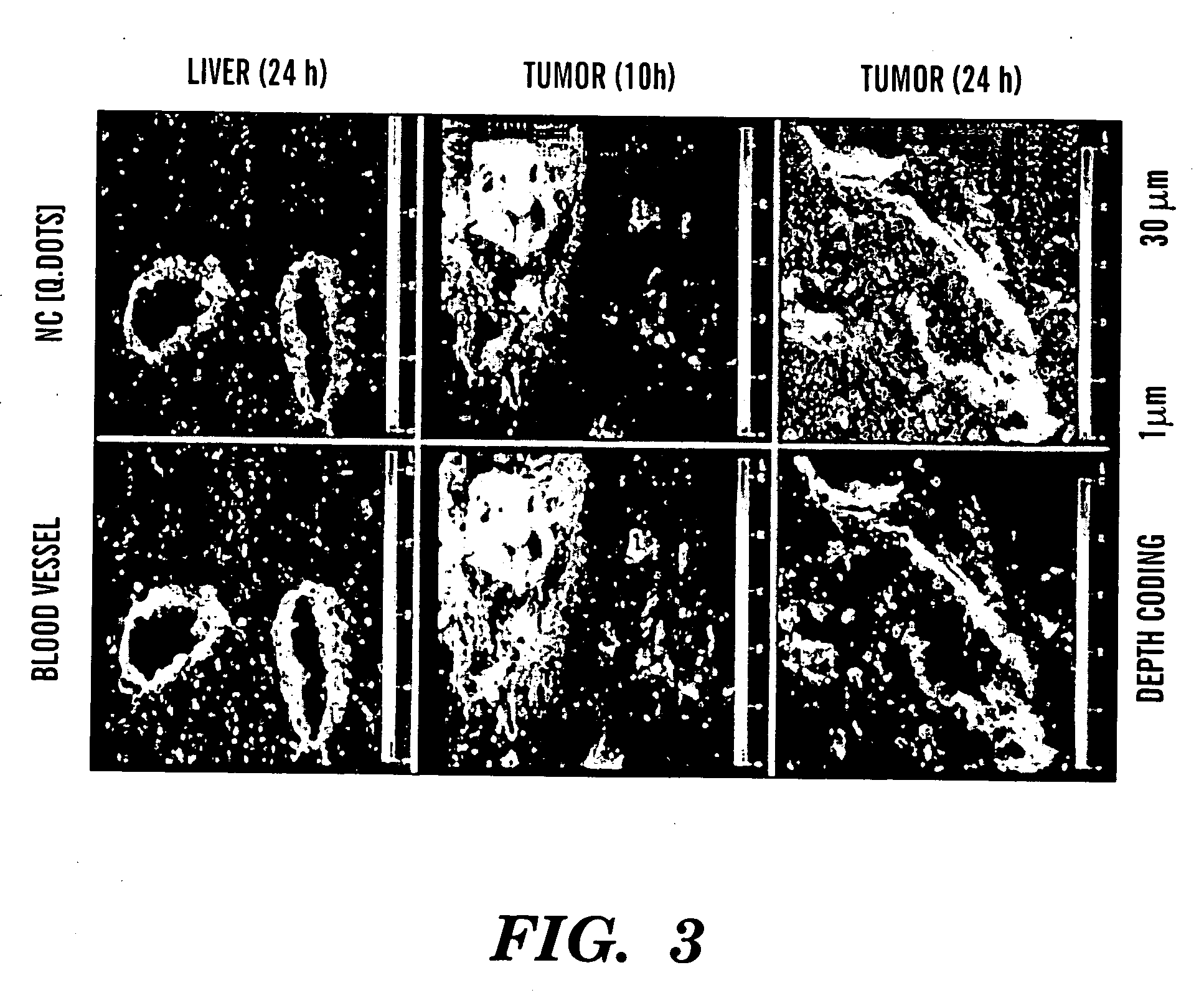 Nanocells for diagnosis and treatment of diseases and disorders