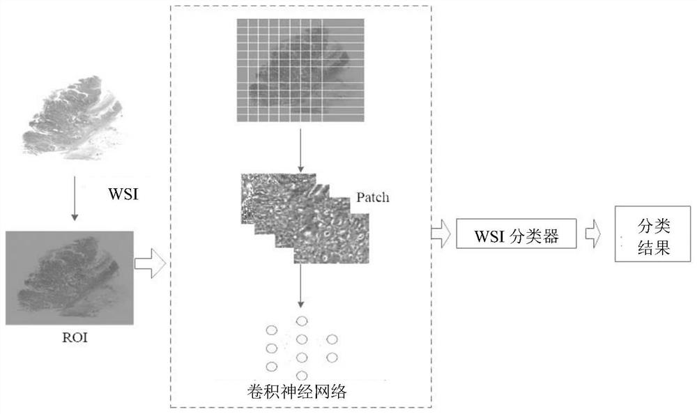 DMMR subtype classification method and system based on pathological image